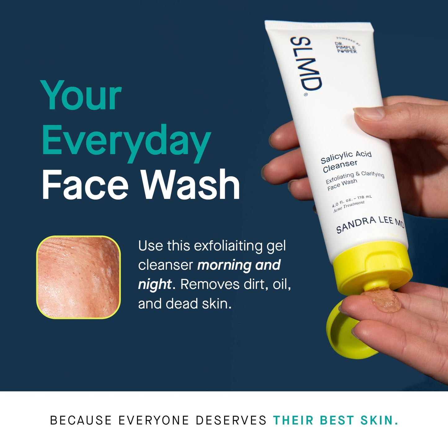 SLMD by Dr. Pimple Popper Salicylic Acid Exfoliating Gel Cleanser for Acne-Prone Skin – Reduces Blackheads & Whiteheads, 4 fl oz