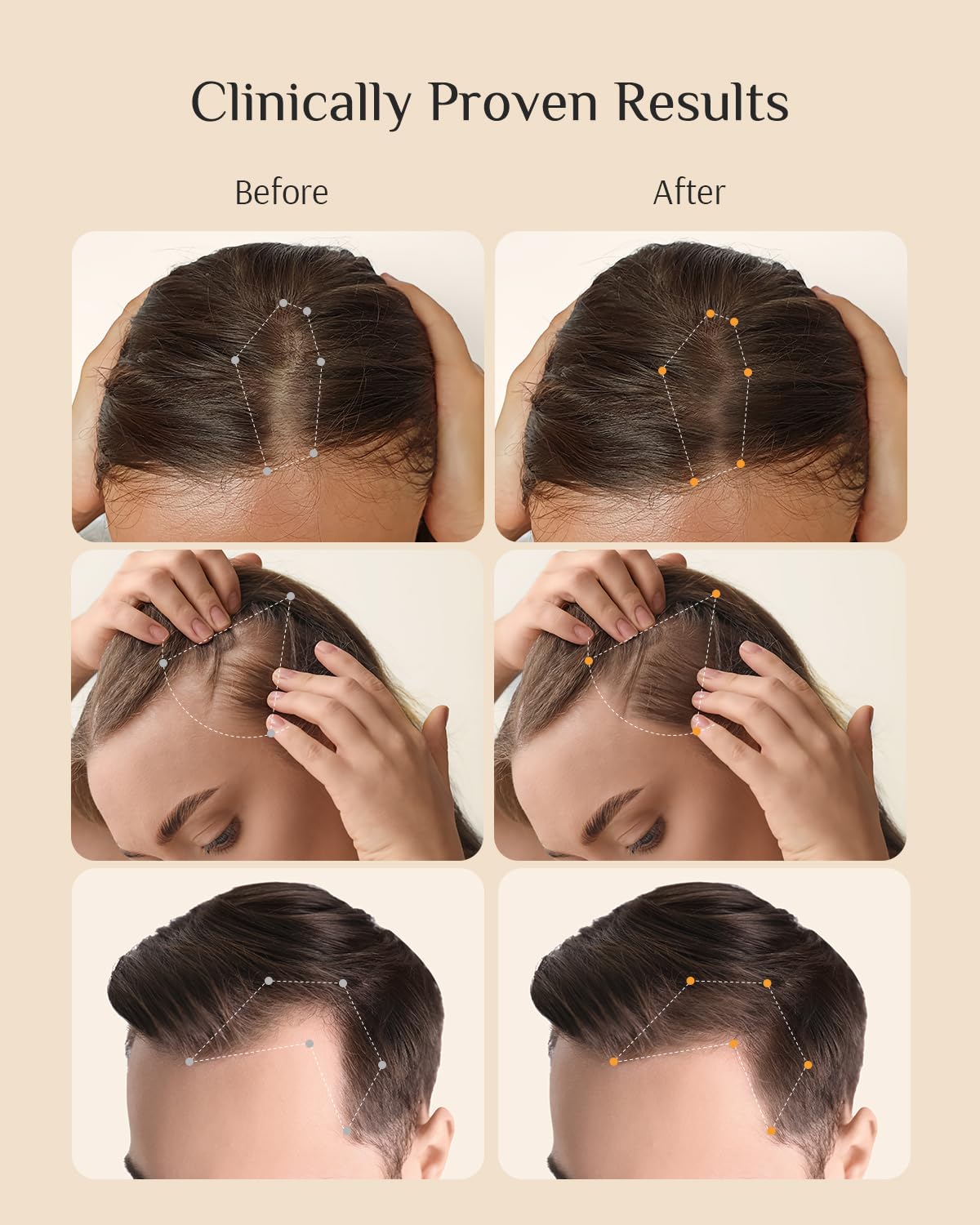 DR ZERO REDENICAL Hair Growth Conditioner for Women 13.5 oz | Volumizing, Thickening & Anti-Hair Loss | Redensyl Formula for Hair Regrowth