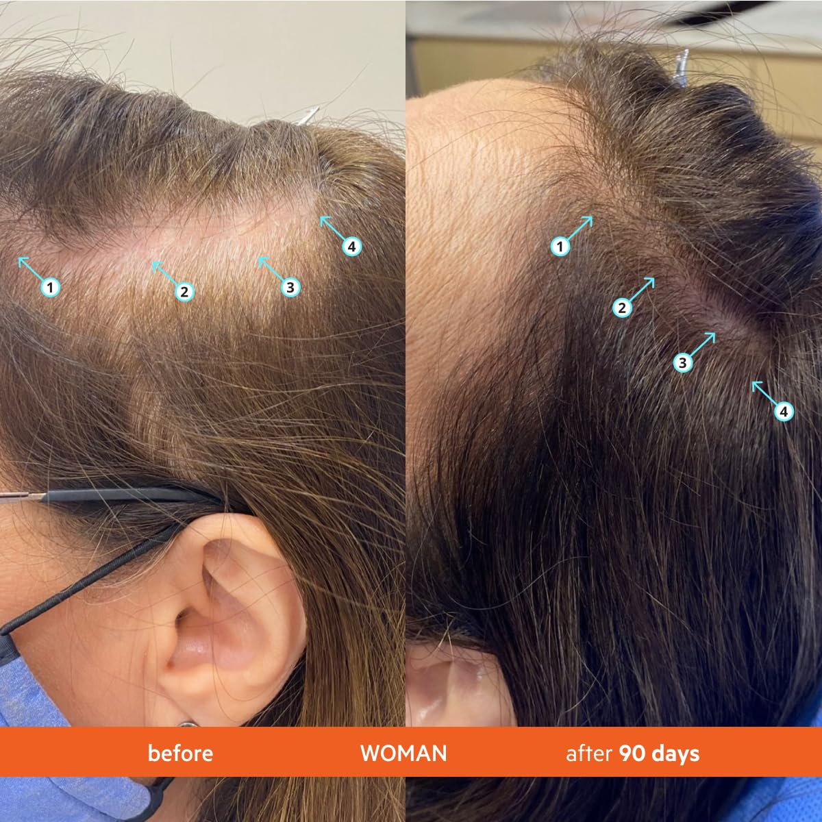 DS Labs Revita Shampoo 205mL – Thickening & Volumizing Cleanse for Fuller-Looking Hair, Lightweight Hydration, Sulfate-Free, Color Safe, Unisex