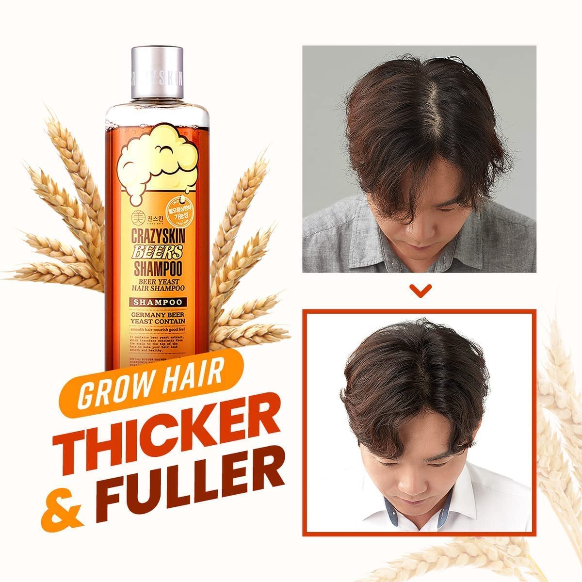 CRAZY SKIN German Beer Yeast Biotin Shampoo 300ml – Anti-Hair Loss, Thickening, Hard Water Defense, Gentle Exfoliating, Sulfate-Free Formula