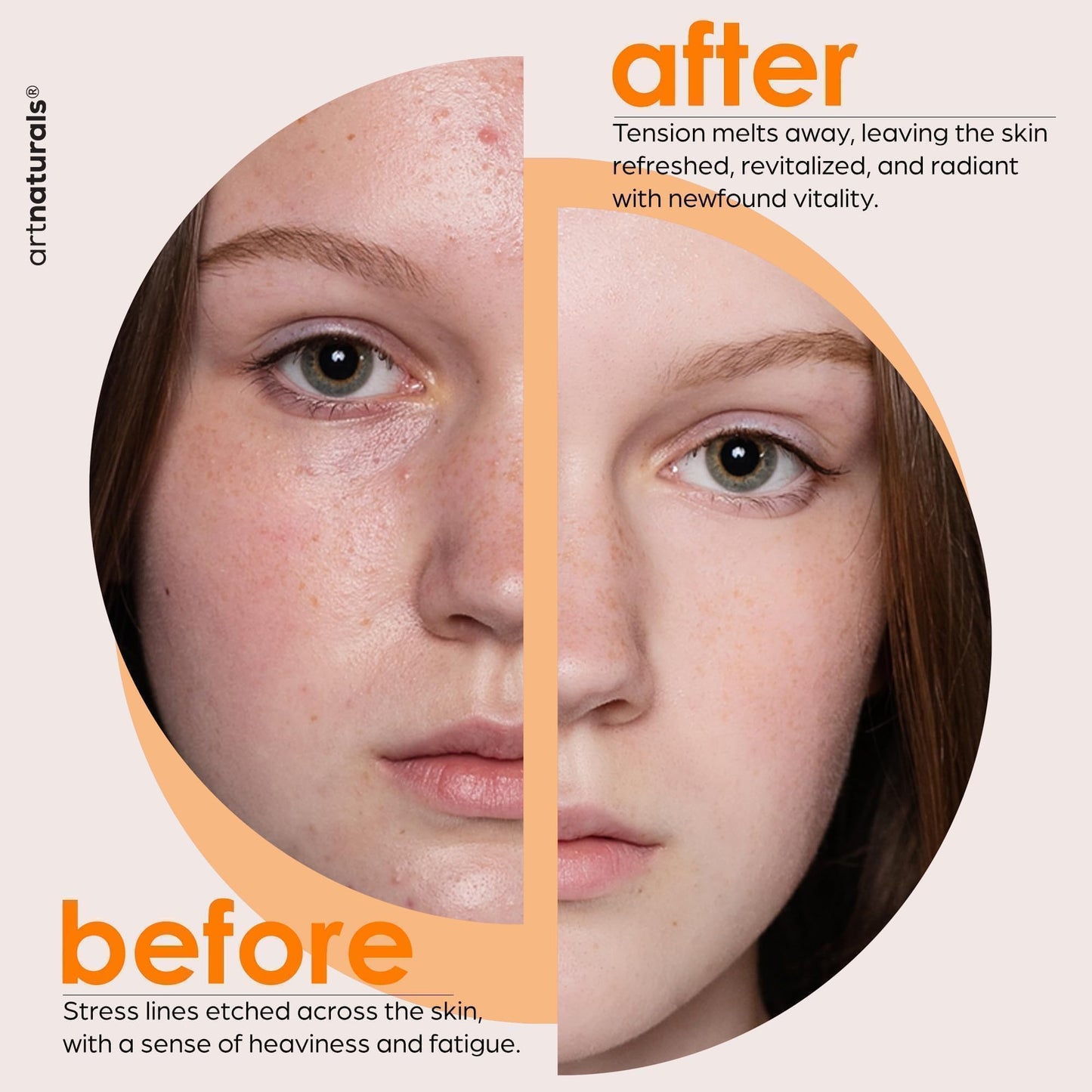 ArtNaturals Vitamin E Bio Oil & Gua Sha Set – Organic Face & Body Moisturizer for Scars, Stretch Marks, Cellulite, Nails & Muscle Massage, 4oz