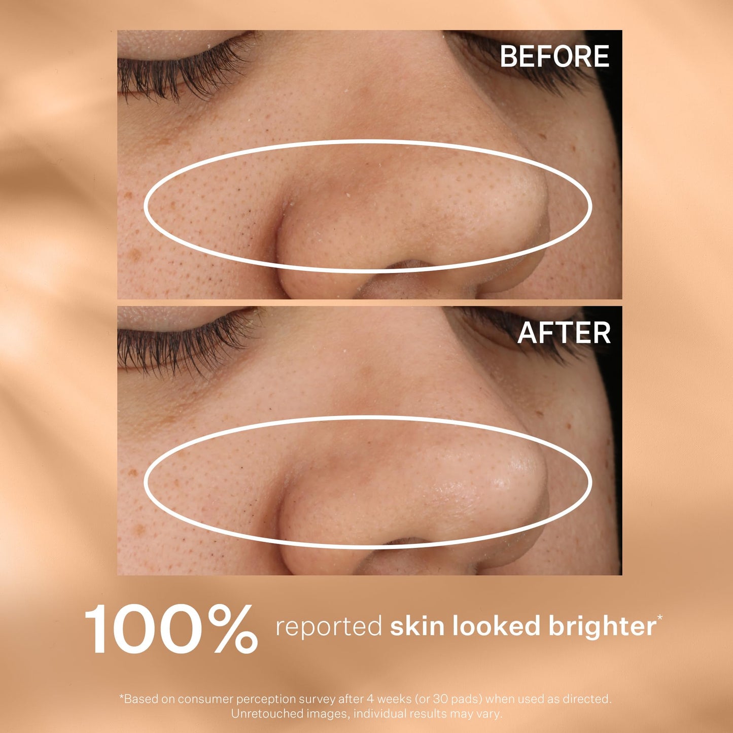 StriVectin Advanced Resurfacing Daily Reveal Exfoliating Face Pads, Visibly Smooths and Brightens Skin, Reduces Blackheads, Salicylic Acid, 60 Count