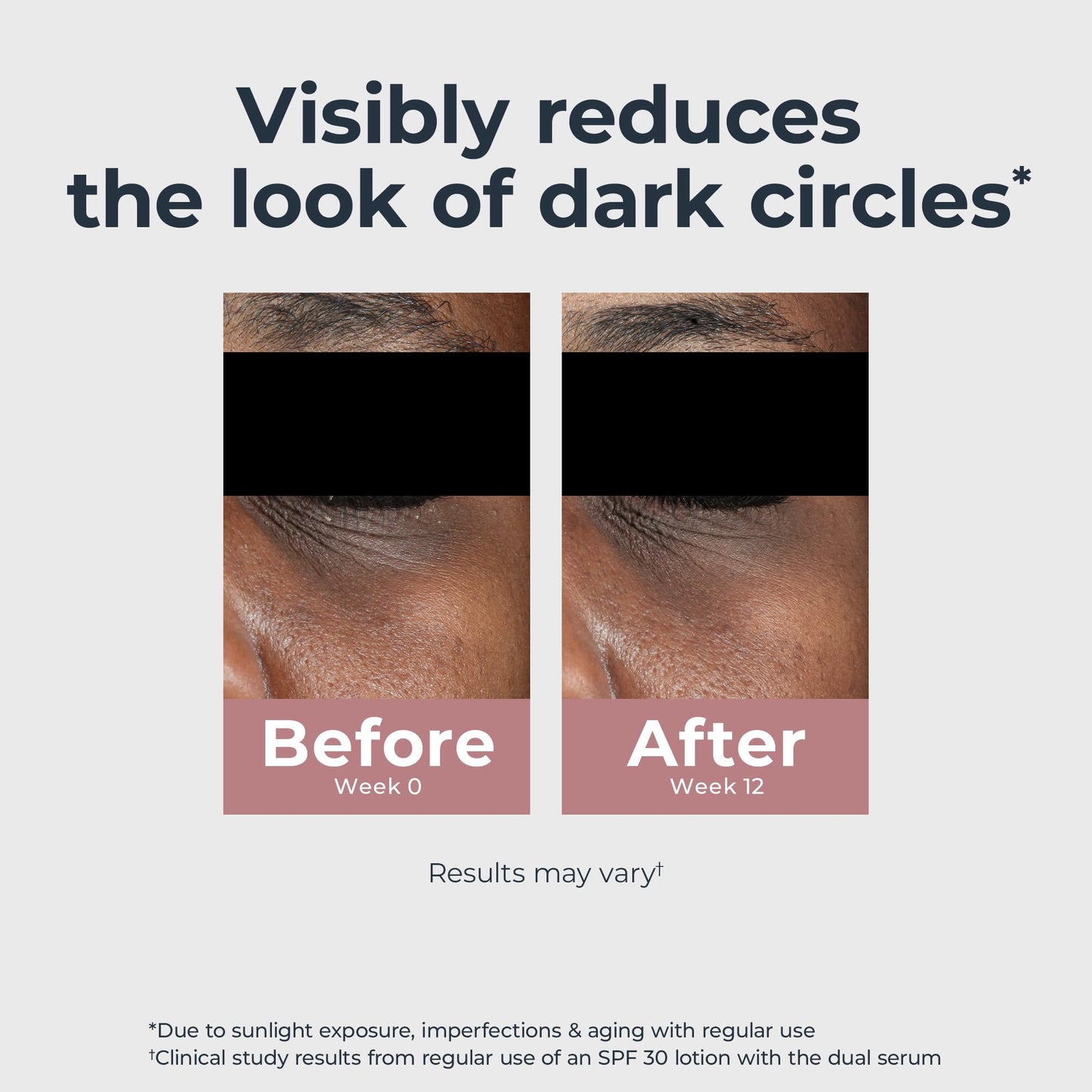 Eucerin Radiant Tone Eye Cream – Dark Circle Corrector with Thiamidol & Hyaluronic Acid, Brightens Eyes & Reduces Puffiness, 0.5 oz