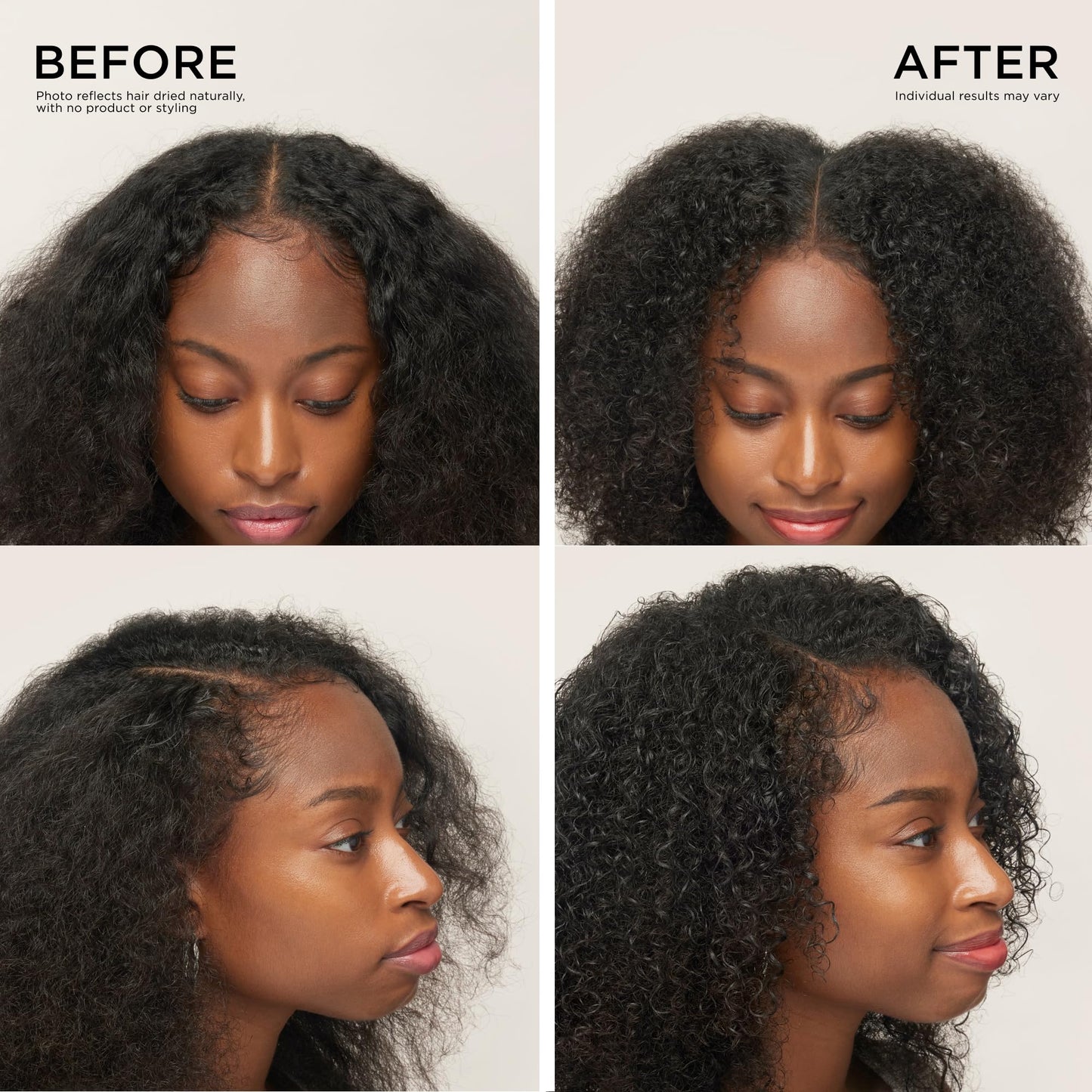 Dr. Groot Hair Thickening Serum Roll-On for Thinning Hair & Hair Loss – Korean Scalp Treatment, Clinically Tested, Reduces Oil, Promotes Thicker Hair