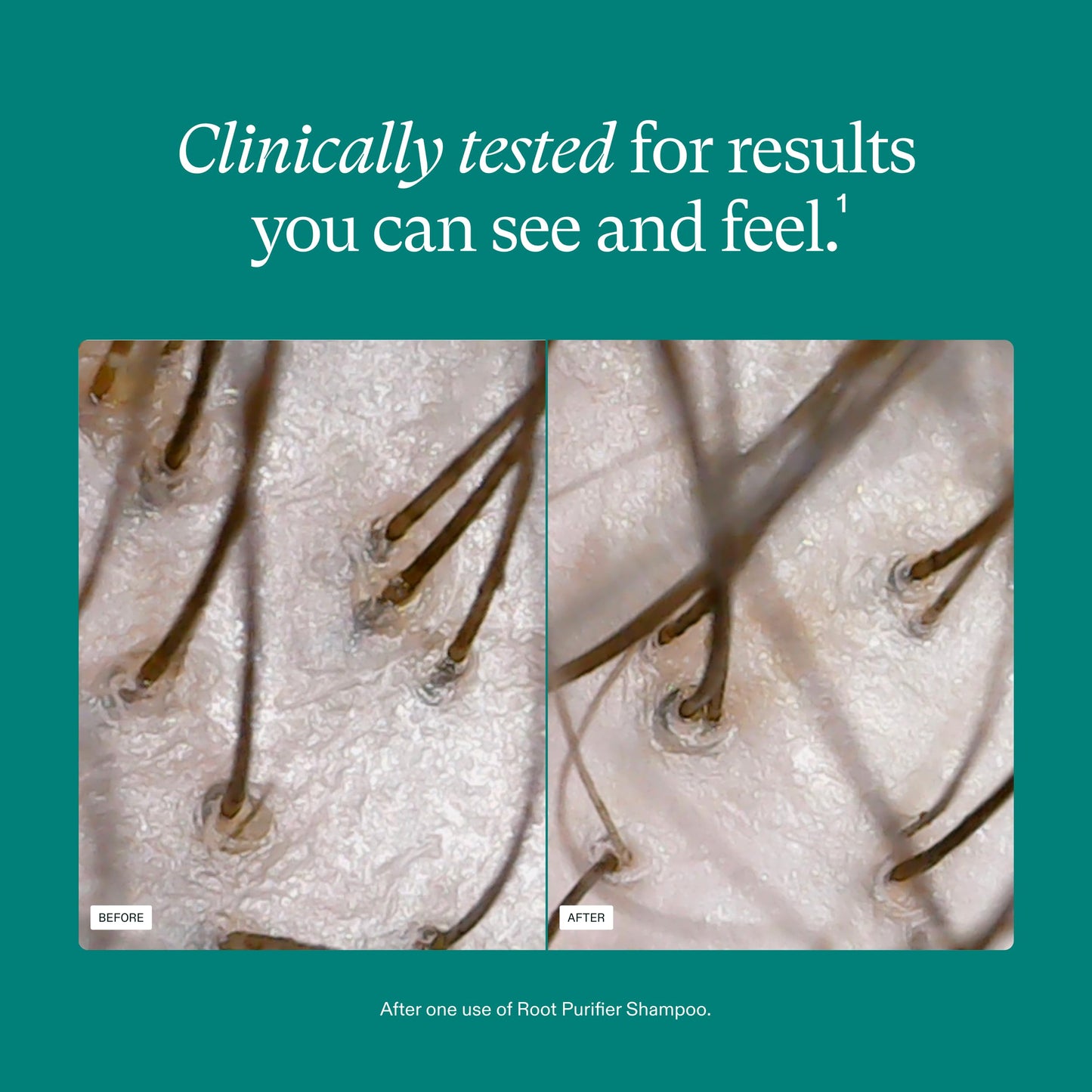 Nutrafol Shampoo for Thinning Hair – Cleanses & Hydrates Scalp, Boosts Volume, Strength & Texture, Color-Safe, Sulfate-Free, 8.1 Fl Oz