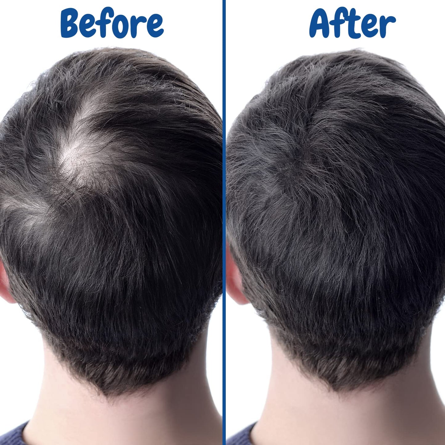 Verseo Sup Hair Growth Conditioner Treatment | Conditioner for Thinning Hair and Hair Loss | Repairing Damaged Hair | 28 Day Supply