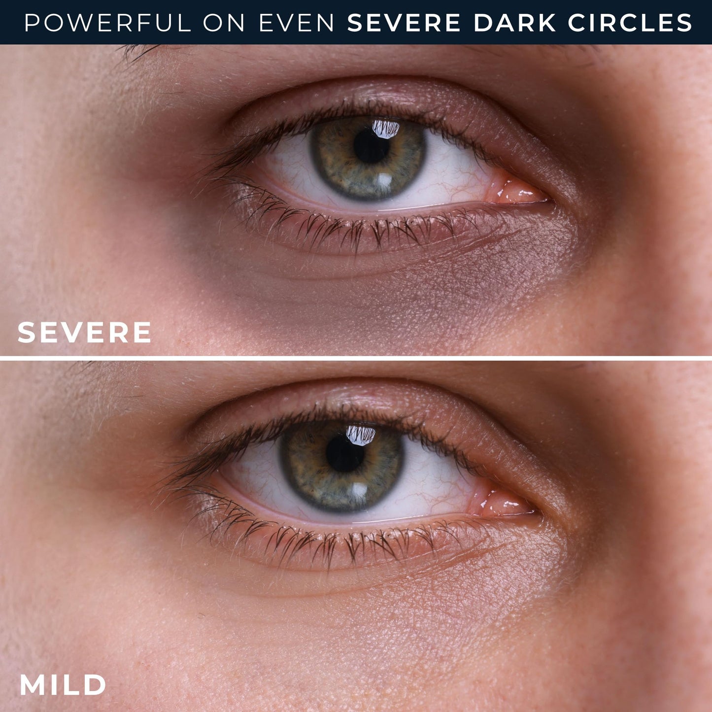 RoC Derm Correxion Retinol Eye Cream with Niacinamide & Resveratrol – Treat Dark Circles, Puffiness, Wrinkles & Crow's Feet, Line Smoothing Packette