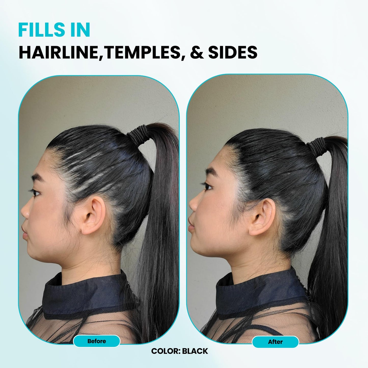 SURETHIK Hair Fibers, 15g (Dark Brown), Fills Thinning Hair for Visibly Fuller Look, Conceals Bald Spots, Natural Look, For Men & Women