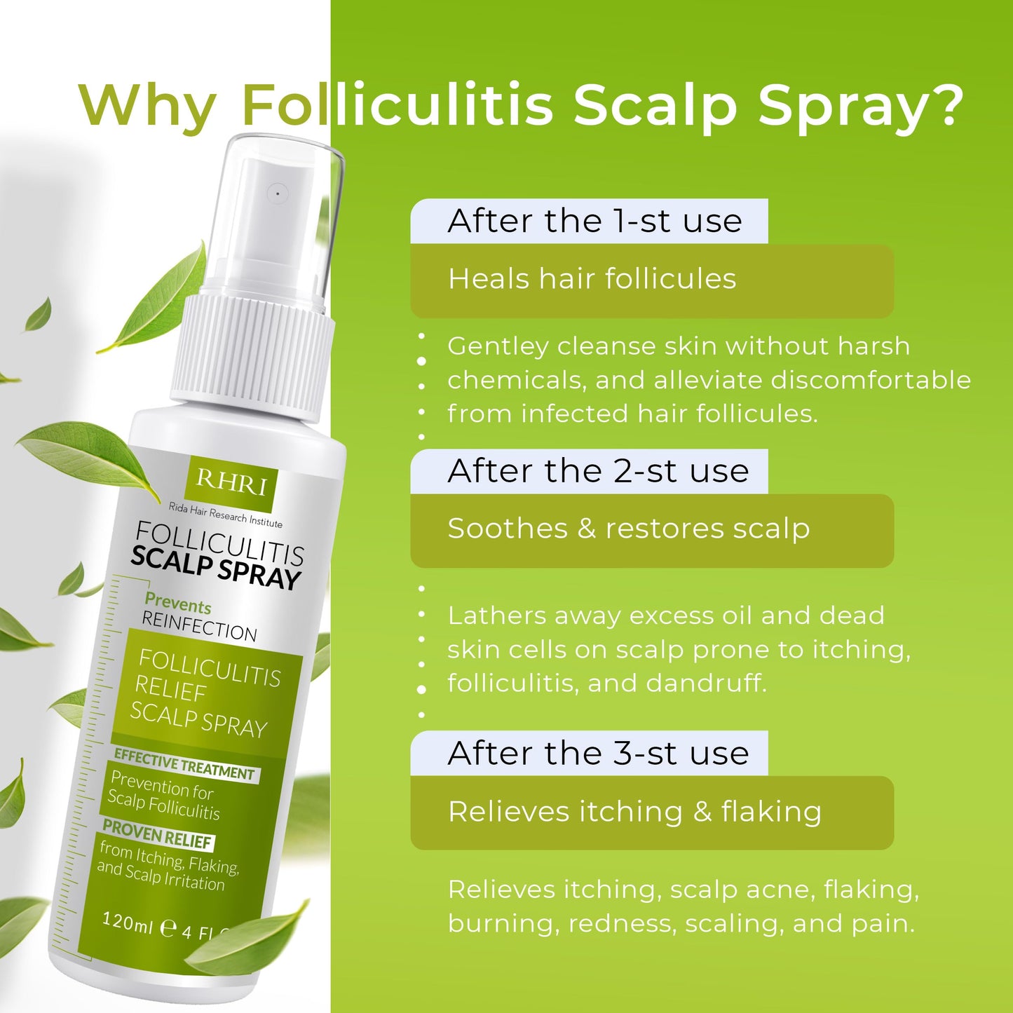 Folliculitis Scalp Spray – Antifungal, Anti-Dandruff & Anti-Itch Treatment for Dry, Irritated Scalp | Helps Soothe Psoriasis & Dandruff Flakes