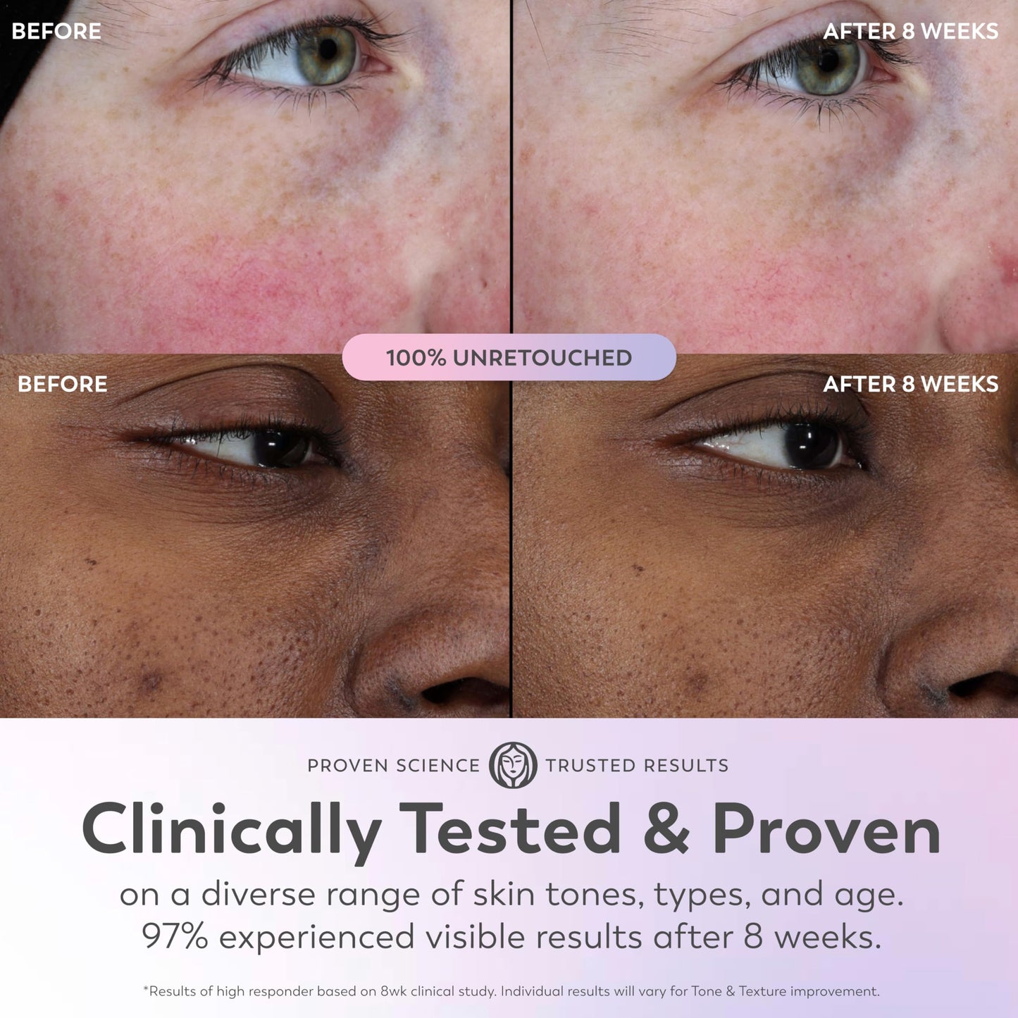 Olay Super Serum with Niacinamide, Vitamins C & E, Collagen Peptide & AHA – 5-in-1 Face Serum for Brightening, Hydrating & Firming, 1.7 oz