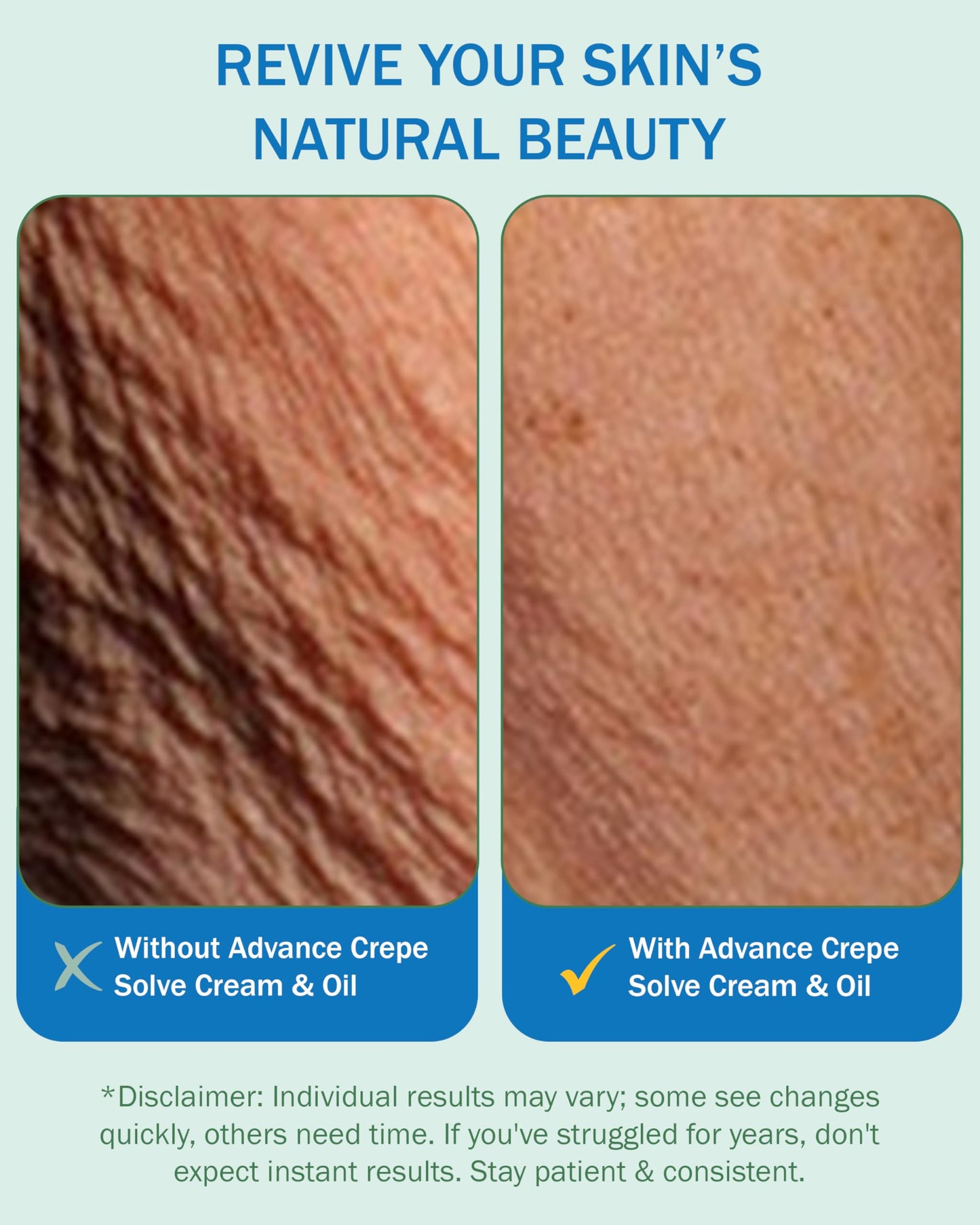 E70 Crepe Skin Set – Firming Cream & Oil with Natural Oils, Licorice Root & Chamomile for Men & Women, Tightens & Smooths, USA Made