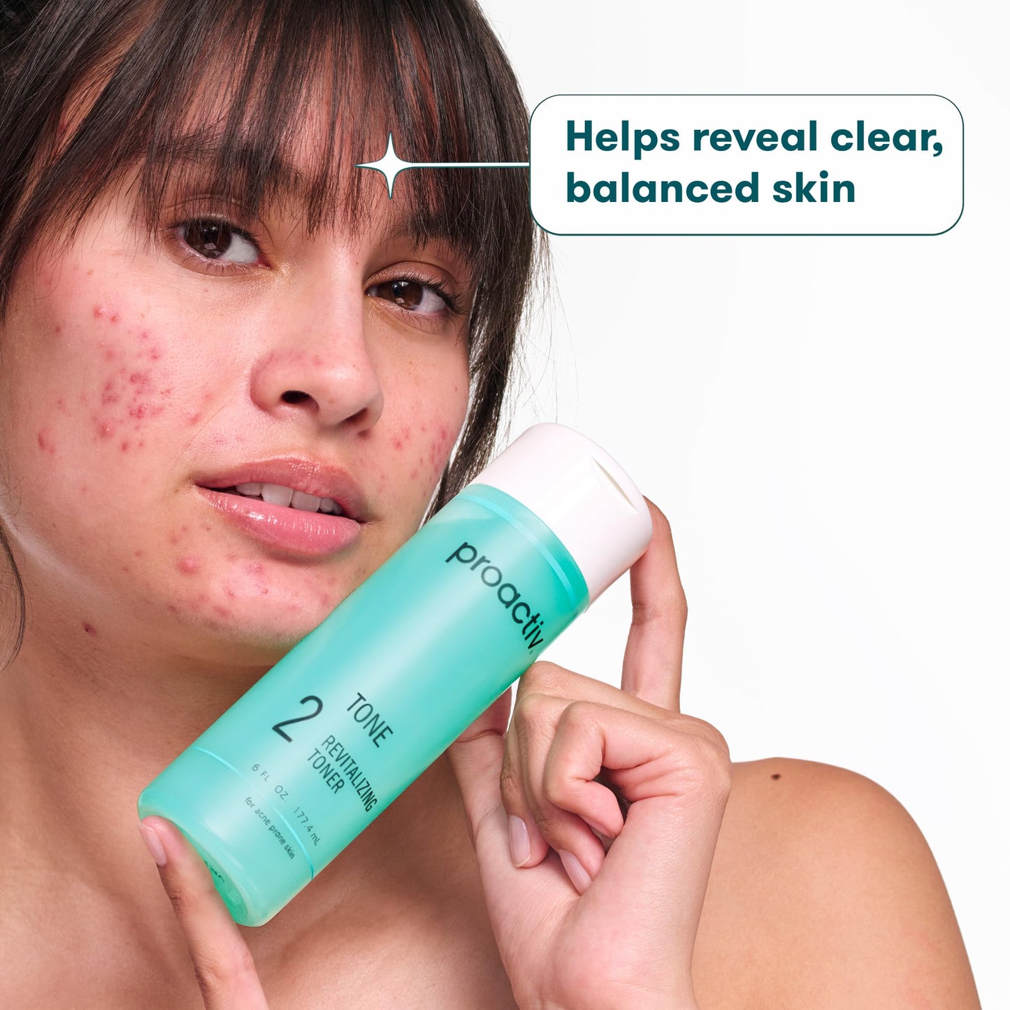 Proactiv Hydrating Facial Toner for Sensitive Skin – Alcohol-Free, Pore-Tightening with Glycolic Acid & Witch Hazel, 6 fl oz