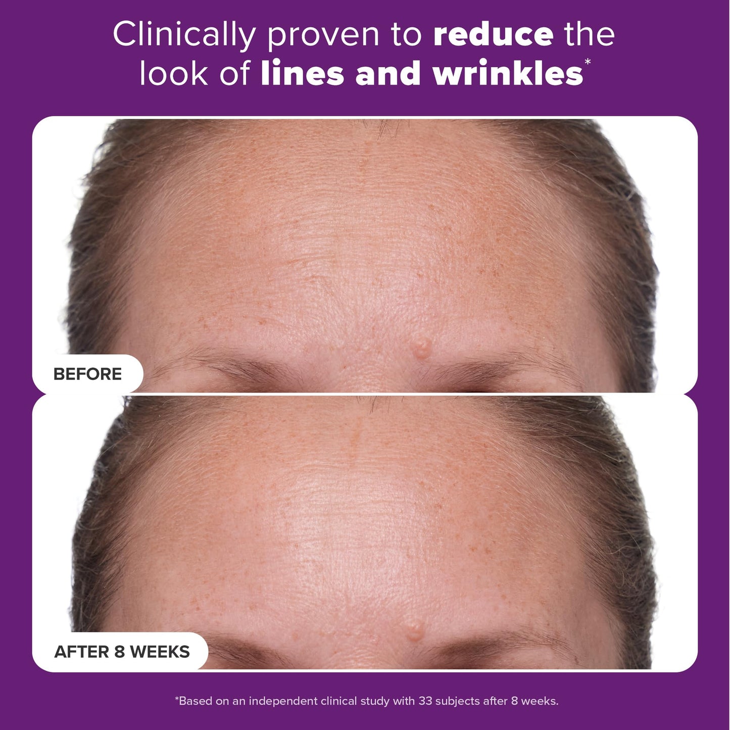 Paula's Choice Clinical 1% Retinol Face Moisturizer with Peptides, Vitamin C & Licorice, Anti-Aging Wrinkle Cream, 1 fl. oz