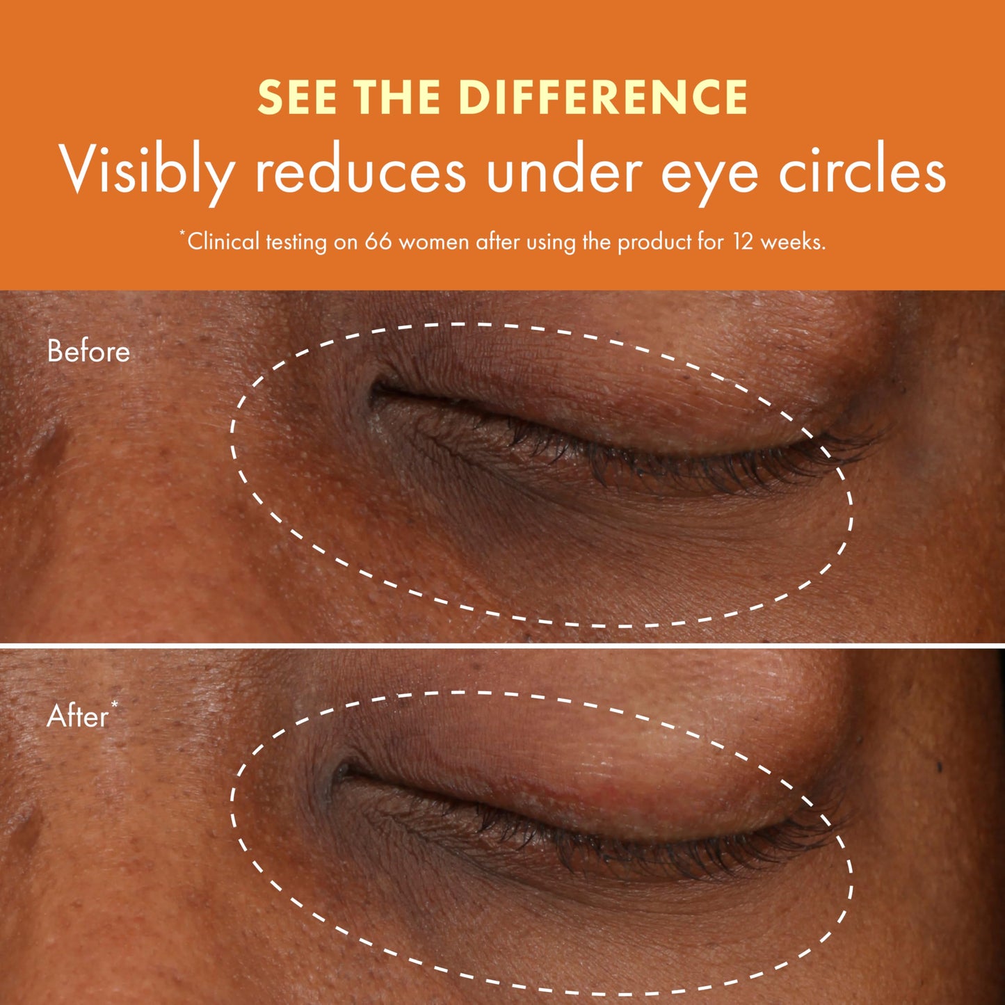 Origins GinZing Brightening Eye Cream with Vitamin C & Niacinamide| Visibly Reduces Dark Circles, Cool, 0.5 Fl Oz