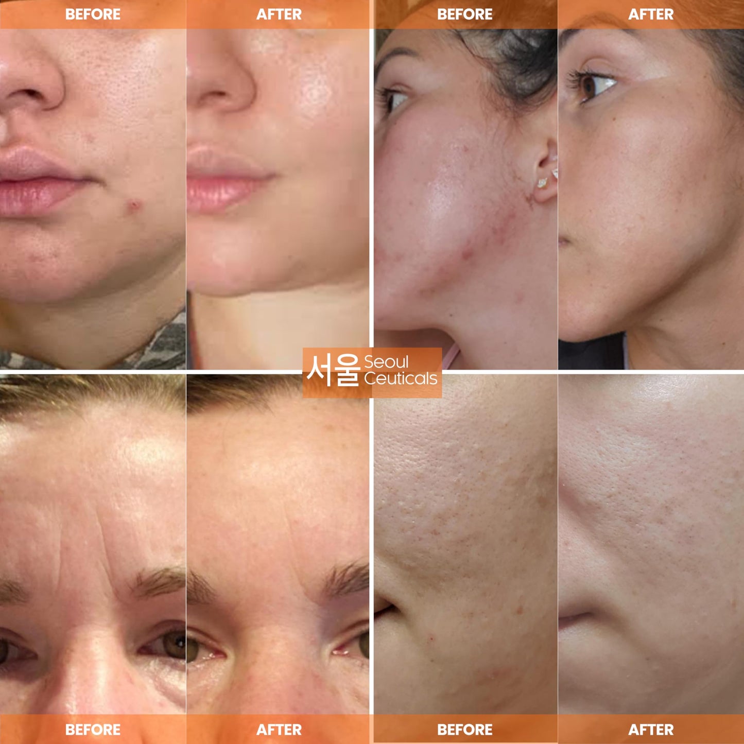 SeoulCeuticals Korean Skin Care 97.5% Snail Mucin Moisturizer Cream - K Beauty Skincare Day & Night Snail Repair Cream Filtrate Cruelty Free 2oz