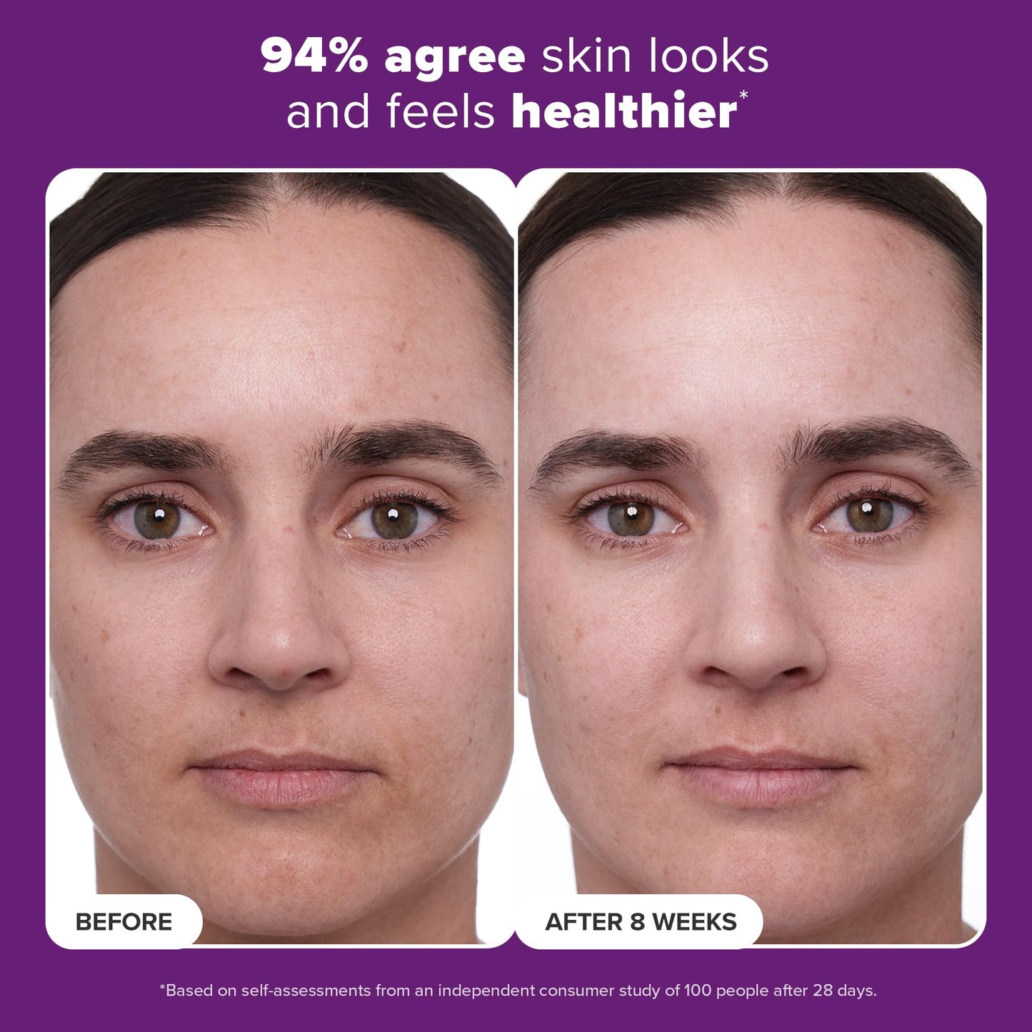 Paula's Choice Clinical 1% Retinol Face Moisturizer with Peptides, Vitamin C & Licorice, Anti-Aging Wrinkle Cream, 1 fl. oz