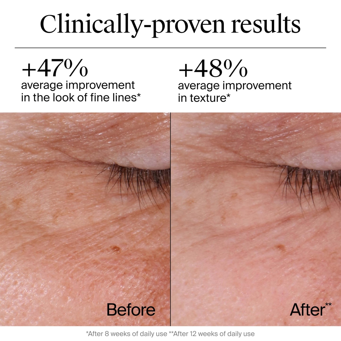 Neutrogena Rapid Wrinkle Repair Retinol Face Moisturizer – Daily Anti-Aging Cream with Retinol & Hyaluronic Acid, 1.7 oz