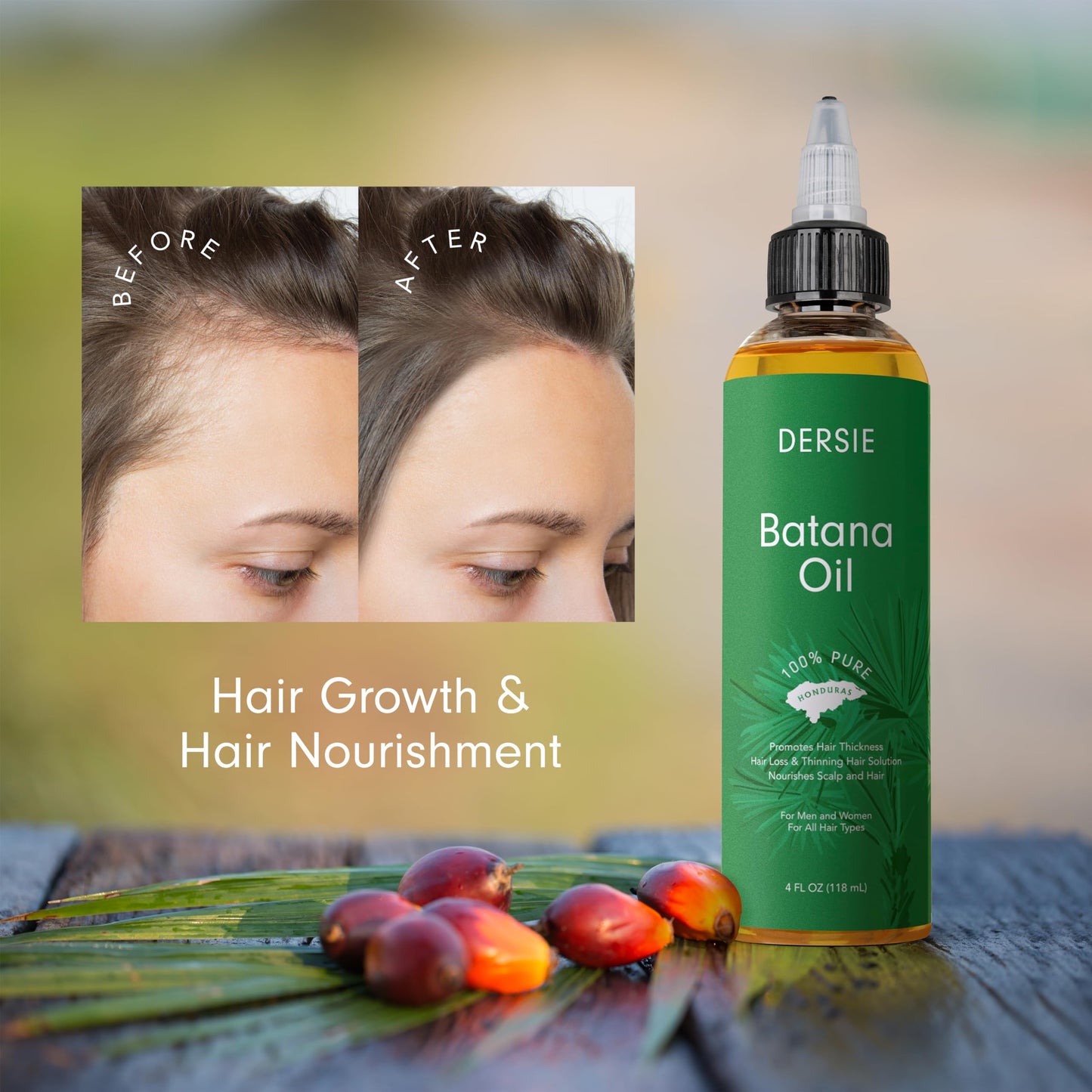 Dersie Batana Oil for Hair Growth: Dr Sebi Organic Raw Batana Oil from Honduras - 100% Pure & Natural - For Thicker & Stronger Hair - 4 FL OZ