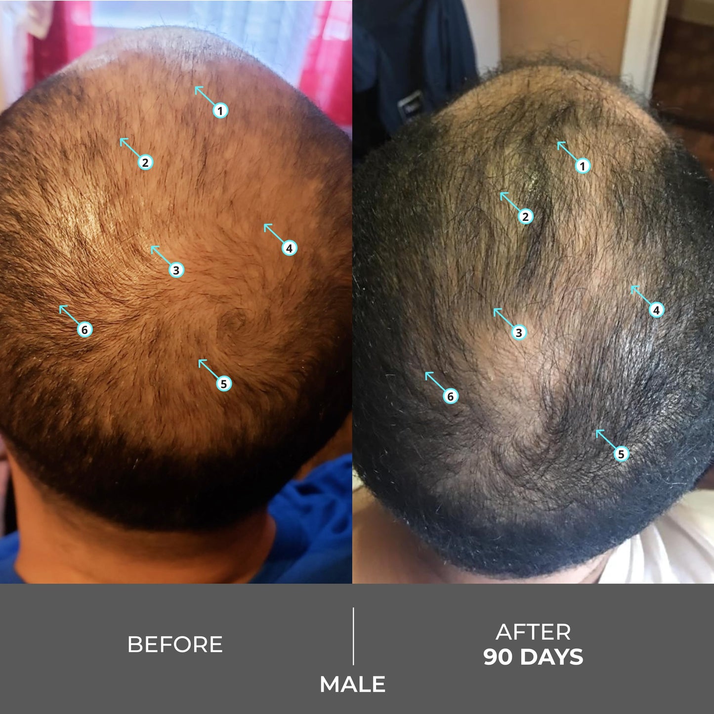 DS Labs Revita Extra Strength Shampoo 205mL – Promotes Fuller, Thicker Hair, Lightweight Hydration, Sulfate-Free & Color-Safe Formula for Men & Women