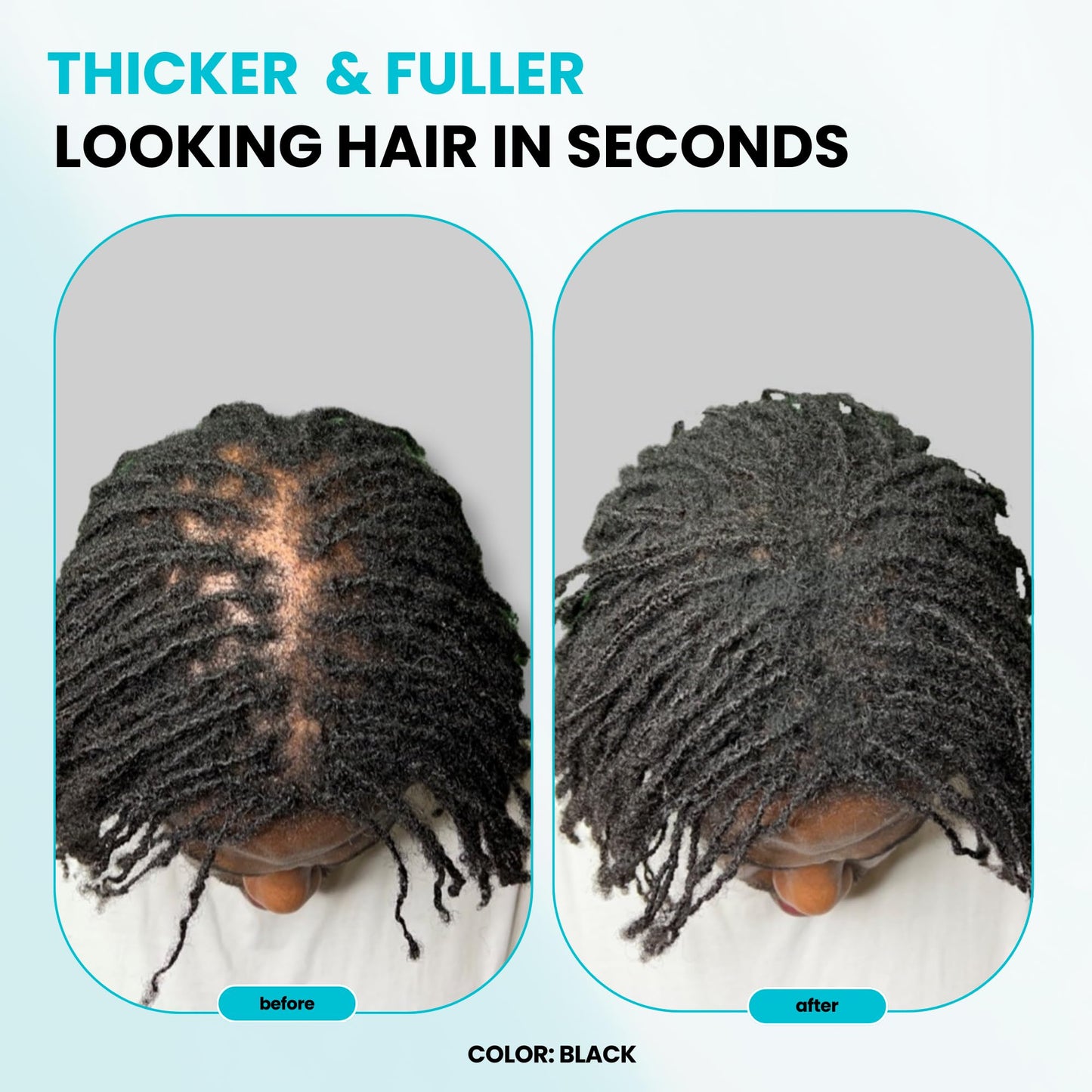 SURETHIK Hair Fibers, 15g (Dark Brown), Fills Thinning Hair for Visibly Fuller Look, Conceals Bald Spots, Natural Look, For Men & Women