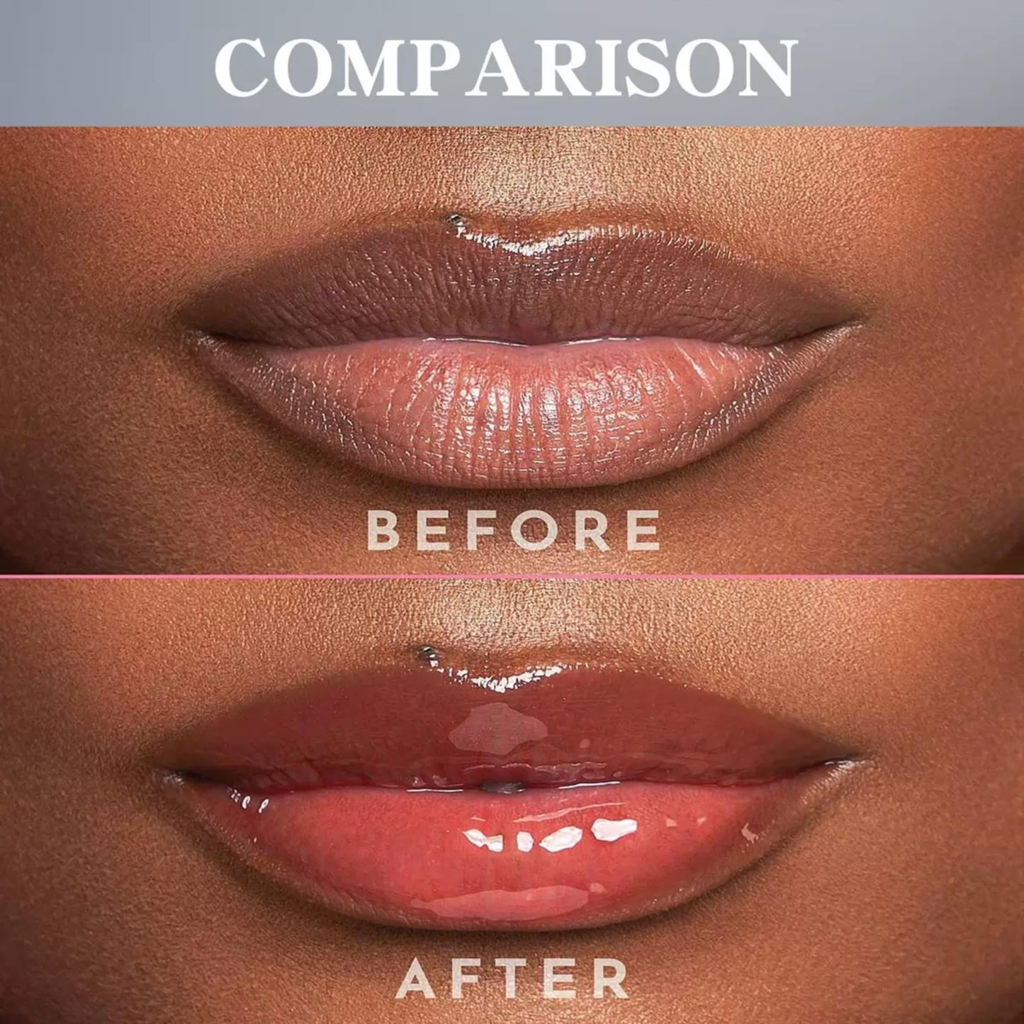 2PCS Turmeric Lip Scrub & Balm Set – Exfoliator for Dark Lips, Moisturizer for Smokers, Softens, Hydrates & Reduces Fine Lip Lines