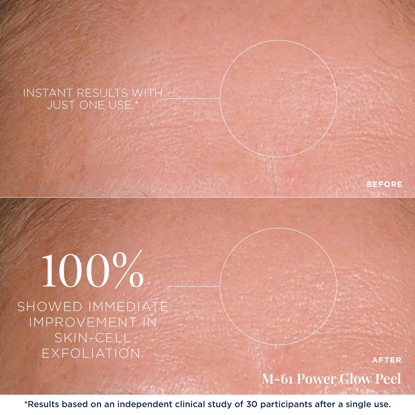 m-61 PowerGlow Peel | Exfoliating Facial Peel With Glycolic, Salicylic Acid. 1 Minute, 1 Step - 30 Treatments