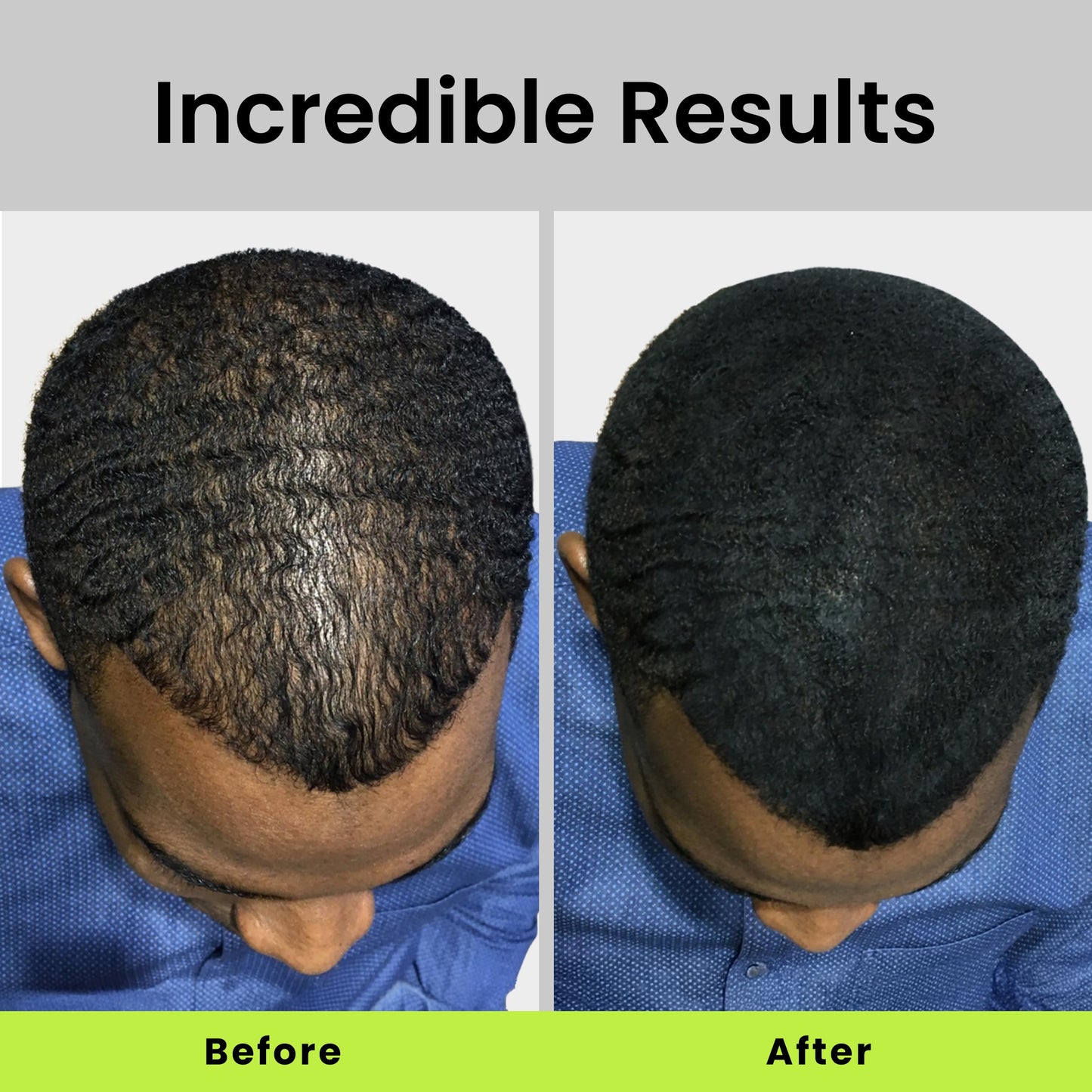 ECLIPSE Hair Fibers Dark Brown for Thinning Hair for Women & Men to Conceal Hair Loss in 15 Seconds - 100% Undetectable Hair Building Fibers, 15g