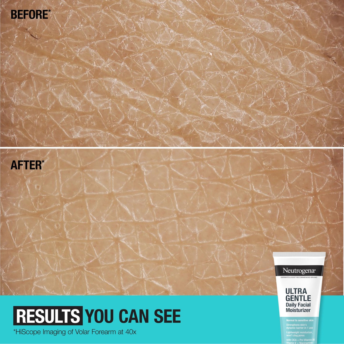 Neutrogena Fragrance-Free Daily Face & Neck Moisturizer for Sensitive Skin with Vitamins B3, B5 & E, 3.4 fl. oz