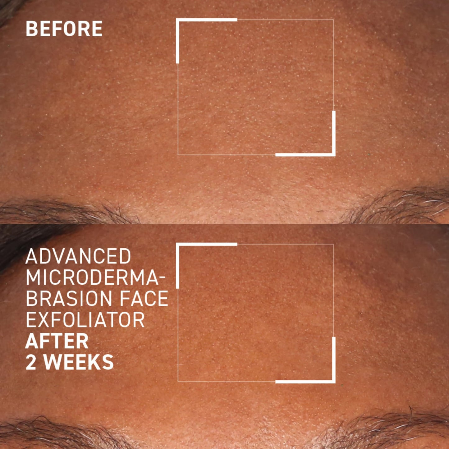 Dr. Brandt Advanced Microdermabrasion Face Exfoliator - Refines Texture, Minimizes the Look of Fine Lines & Enhances Overall Skin Tone - 2 oz