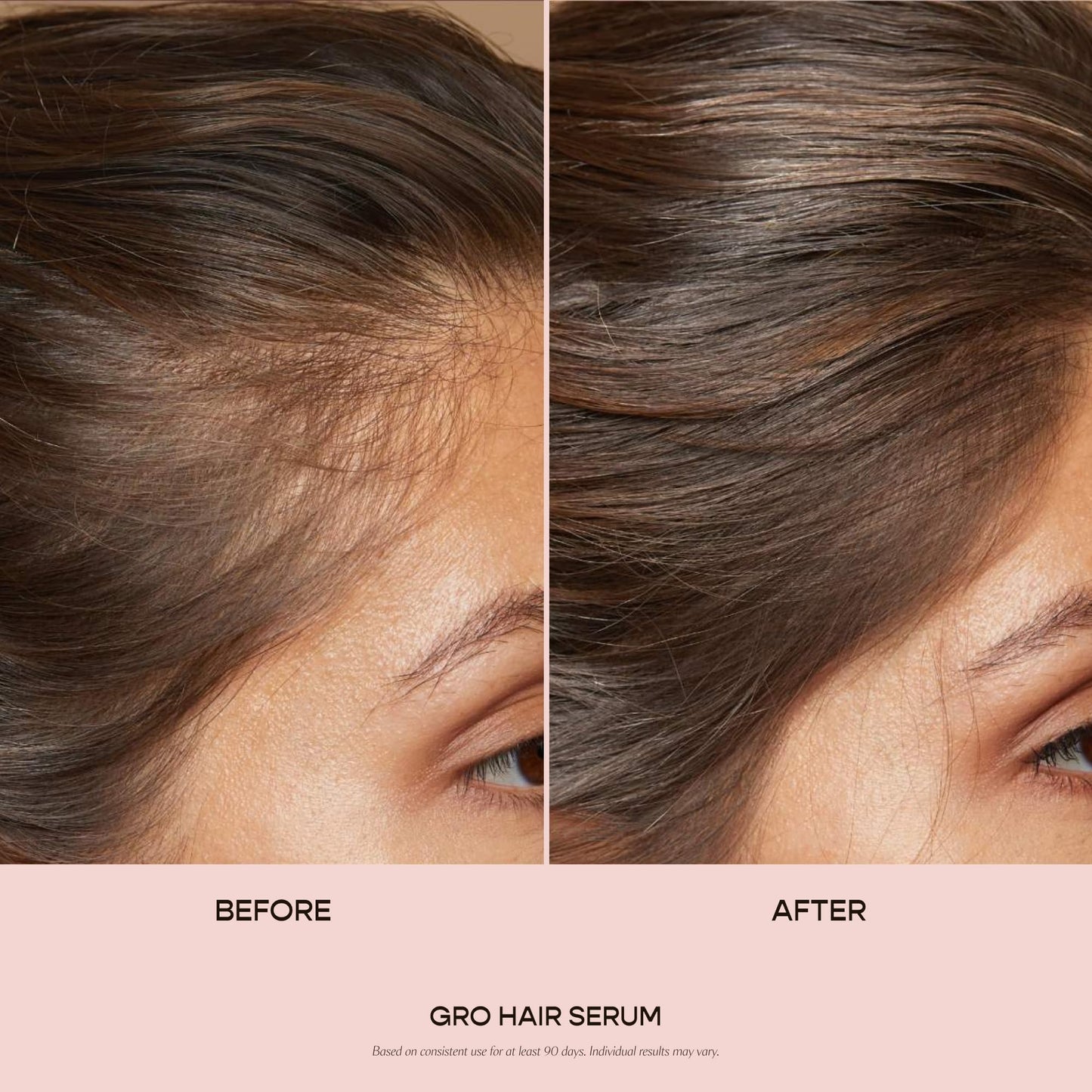 VEGAMOUR GRO Hair Serum for Hair Thinning, Thicker Fuller Looking Hair, Non Oily, 3 pack, 90 day supply