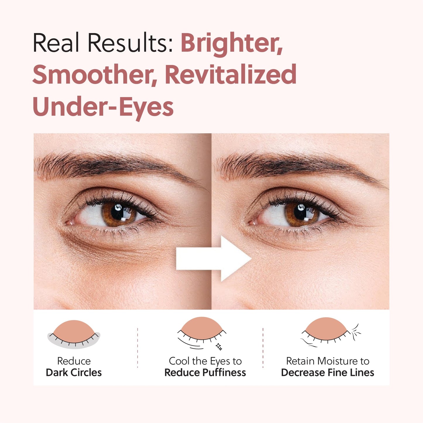 QUIA Hydrogel Eye Patches with Collagen – Depuff, Smooth Fine Lines & Hydrate in 15 Minutes – No-Slip, Soothing Formula – 20 Pairs for All Skin Types