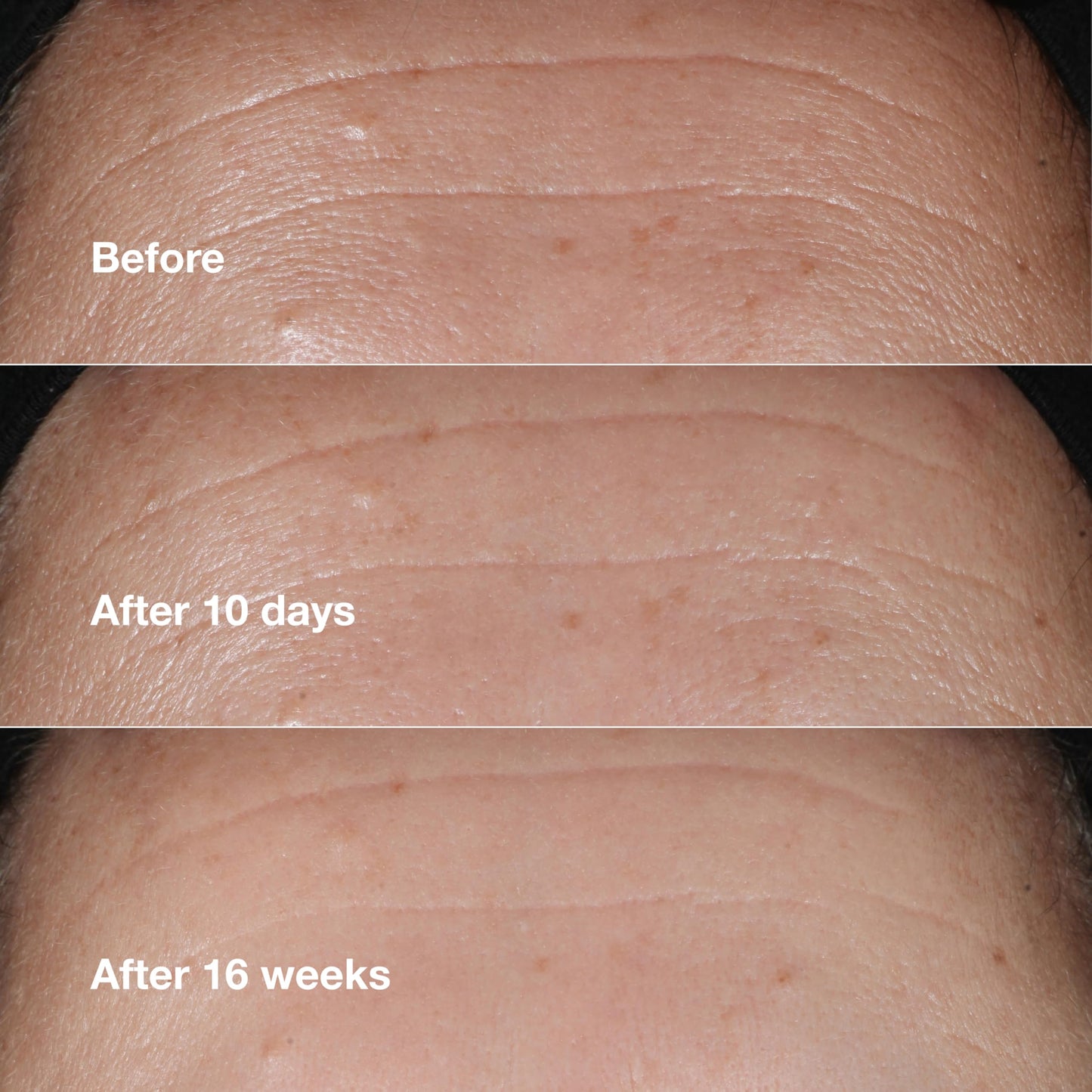 Clinique Smart Skin Gift Set – Wrinkle Repair Cream, Face Serum & Eye Cream | Anti-Aging & Hydrating | 3 Travel-Size Pieces