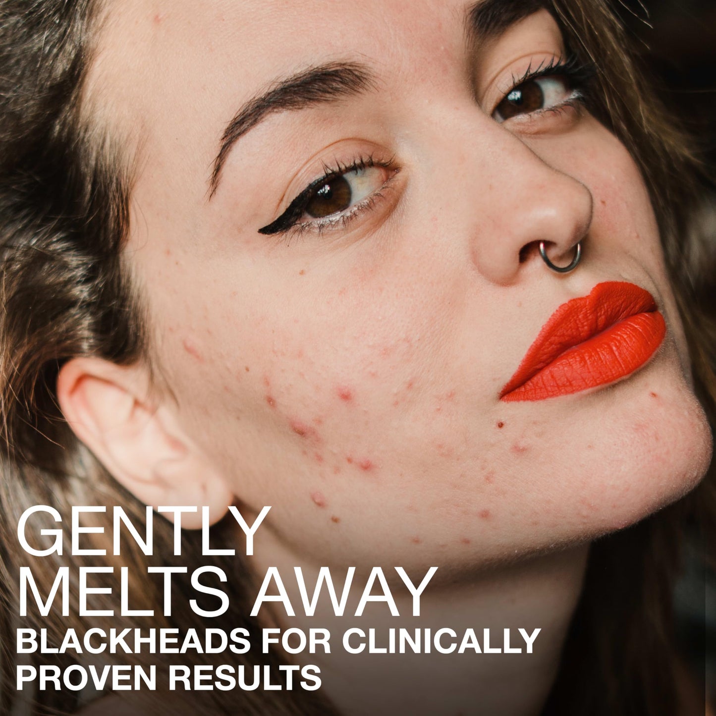 Neutrogena Stubborn Blackheads Daily Acne Serum with Salicylic, Glycolic, Polyhydroxy & Mandelic Acids, Oil-Free Face Serum, 1 fl. oz