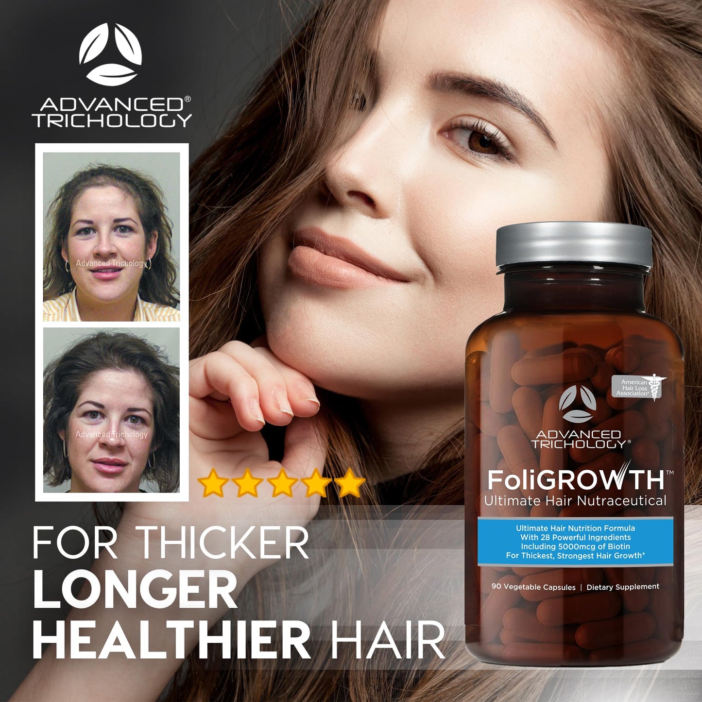 Advanced Trichology FoliGROWTH Hair Growth Supplement – Promotes Thicker, Fuller Hair, Supports Thinning Hair, AHLA Approved, 90 Capsules, 1 Pack