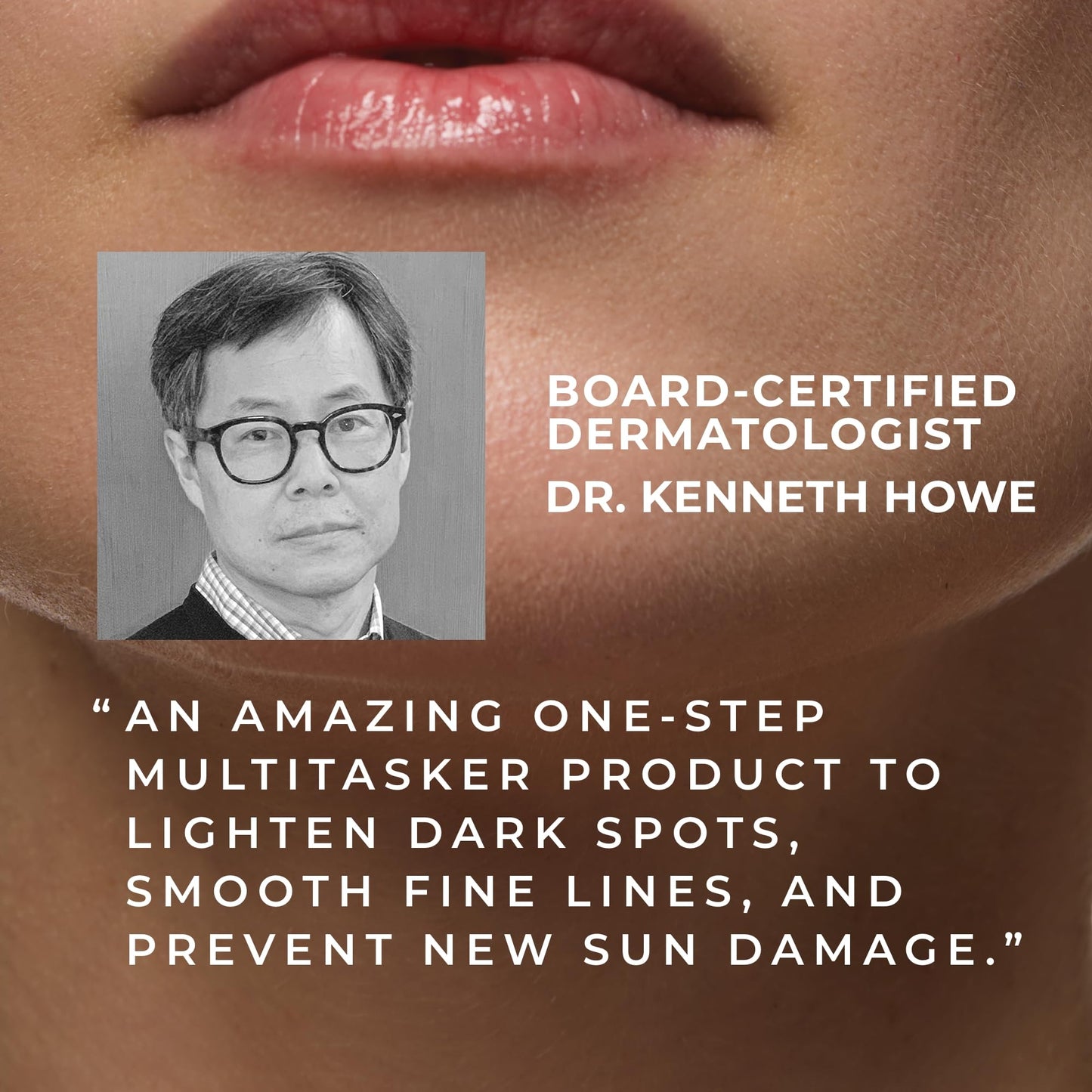 RoC Multi Correxion 5-in-1 Chest, Neck & Face Moisturizer with SPF 30 – Anti-Aging Cream for Wrinkle Reduction, Firming & Tightening, 1.7 oz