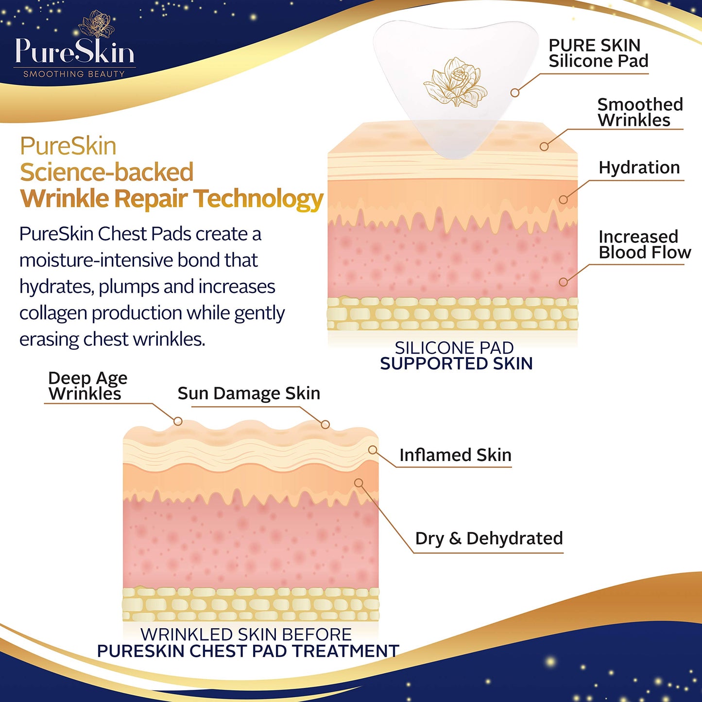 PureSkin 4-Pack Chest Wrinkle Pads – Silicone Anti-Wrinkle Patches for Decollete, Side-Sleeping, & Chest Lines