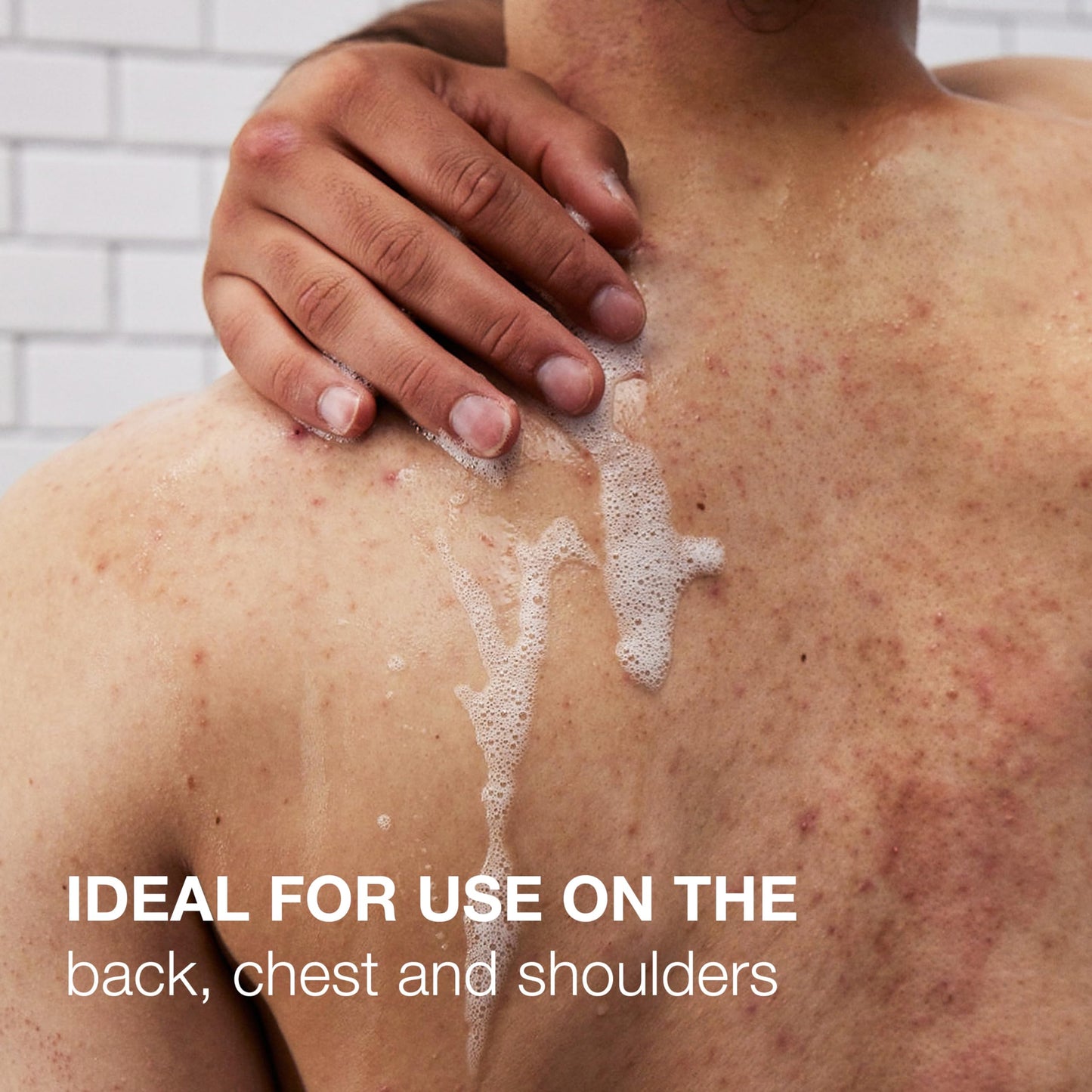 Neutrogena Salicylic Acid & PHA Acne Body Wash – Exfoliating, Fragrance-Free Cleanser for Chest & Shoulders, 8.5 Fl Oz