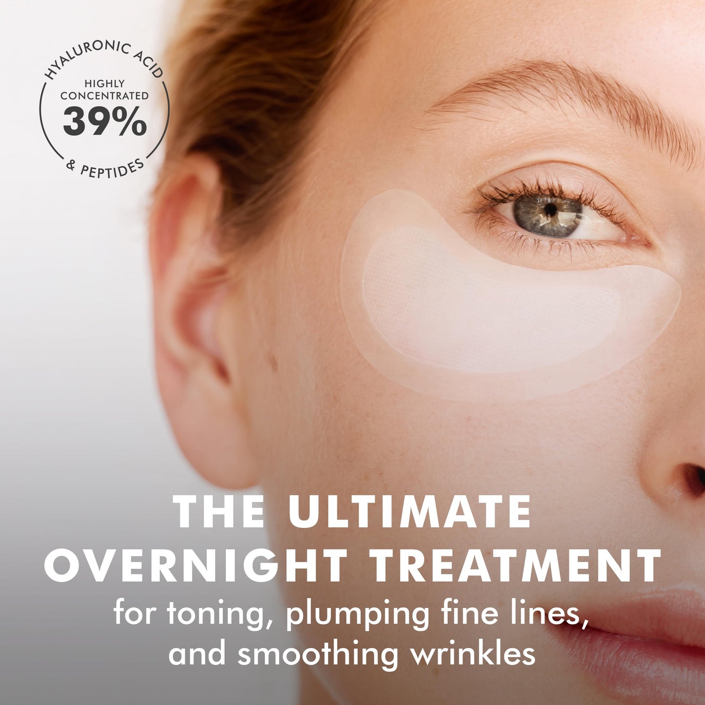 skyn ICELAND Dissolving Microneedle Under Eye Patches, 39% Hyaluronic Acid & Peptides, No-Slip Overnight Mask, 3 Pairs, Vegan