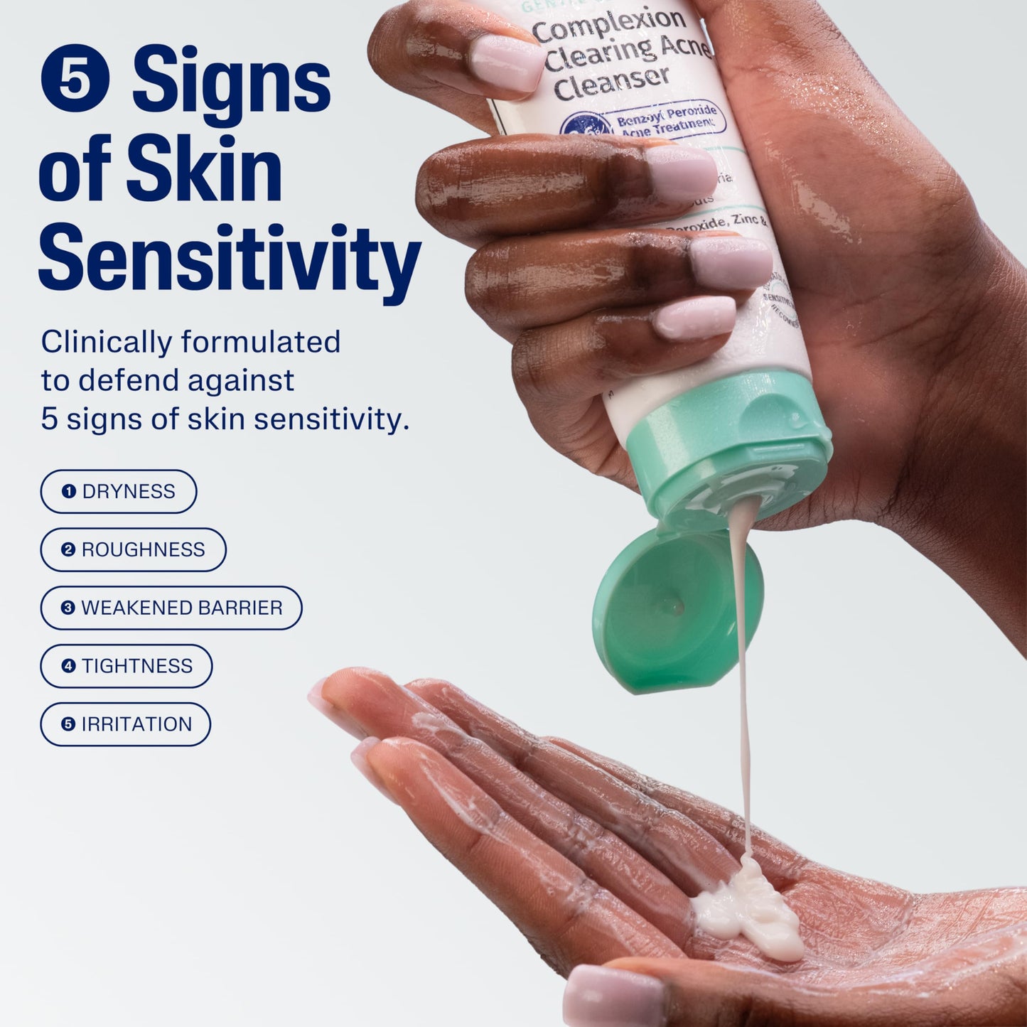 Cetaphil Gentle Clear Acne Cleanser with 2.6% Benzoyl Peroxide – Creamy, Soothing Face Wash for Sensitive & All Skin Types, 4.2 oz