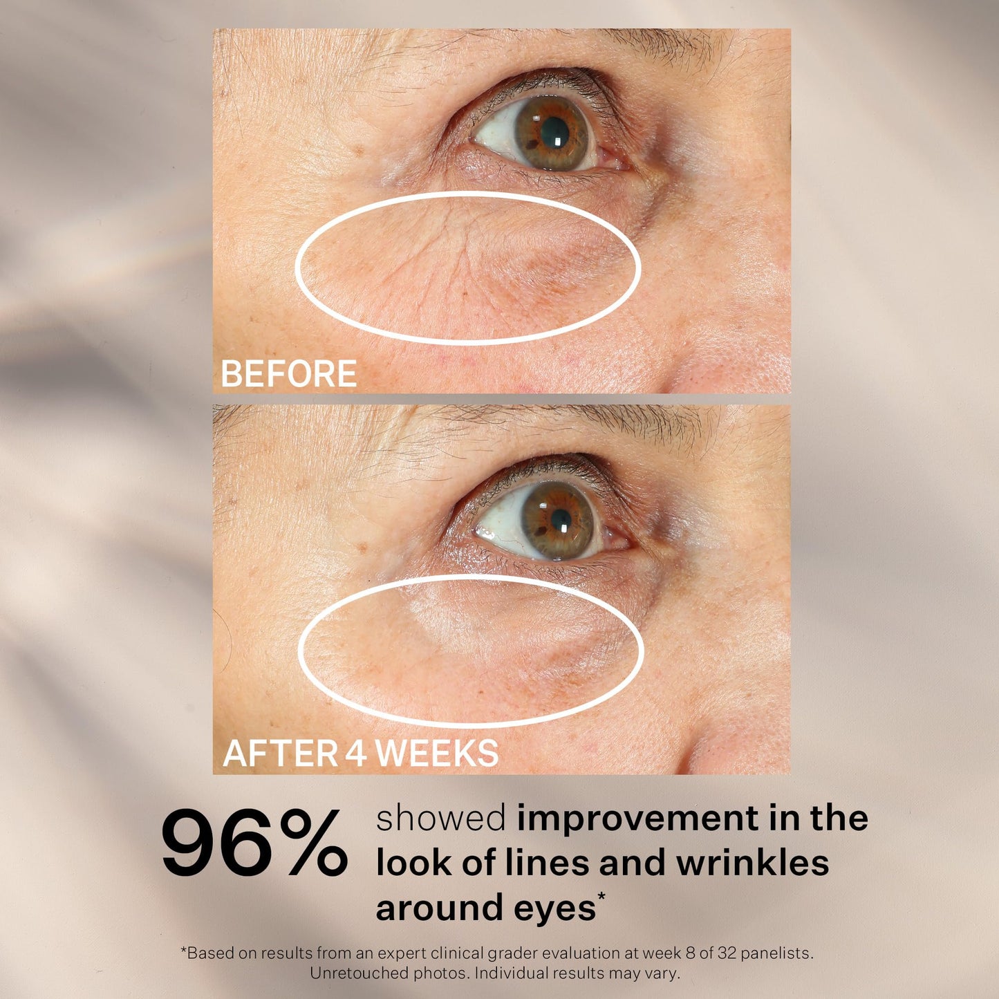 StriVectin Peptight 360° Eye Serum with Tightening & Brightening Peptides for Wrinkles, Puffiness & Under Eye Bags, 1 fl oz