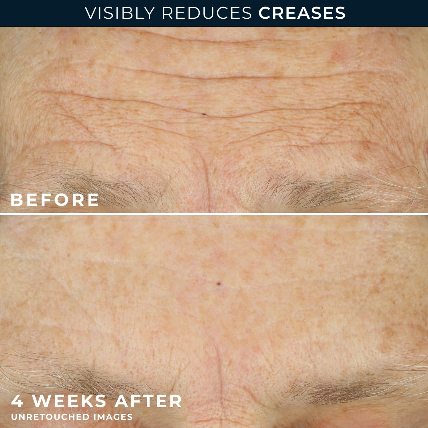 RoC Crepe Repair Daily Face & Neck Moisturizer 1.7oz + Retinol Wrinkle Smoothing Capsules 7ct – Anti-Aging Skincare for Men & Women