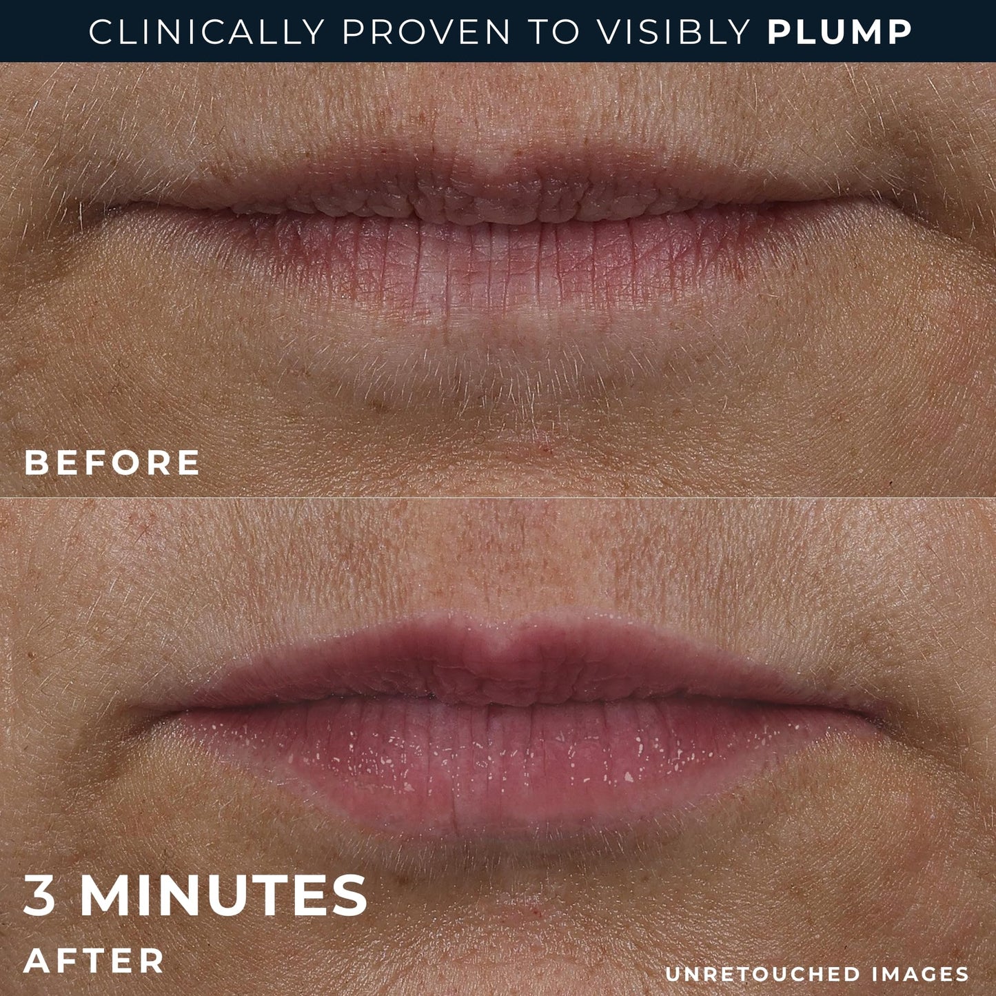 RoC Derm Correxion Lip Volumizer - Lip Plumper Peptide Treatment with Hyaluronic Acid & Vitamin E + Line Smoothing Eye Cream Packette