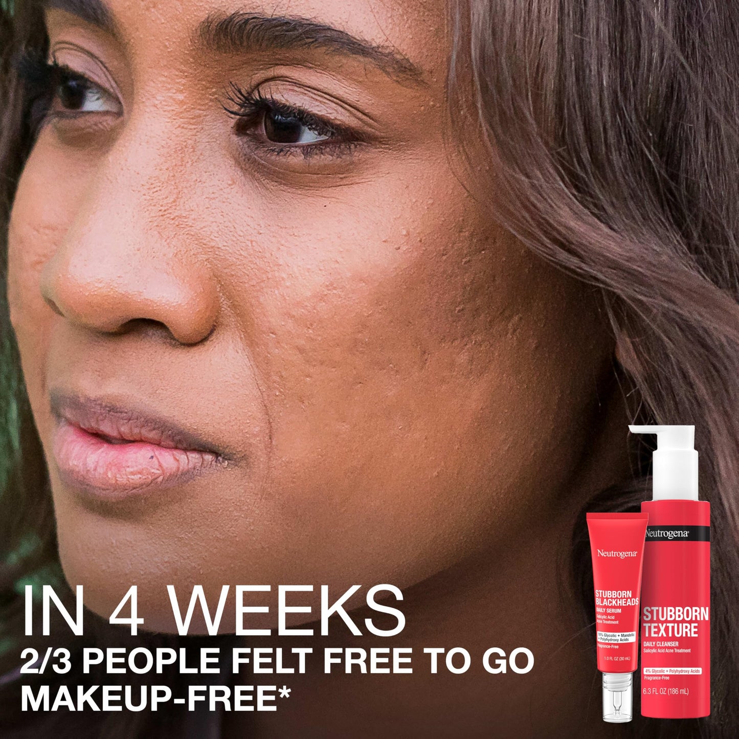 Neutrogena Stubborn Blackheads Daily Acne Serum with Salicylic, Glycolic, Polyhydroxy & Mandelic Acids, Oil-Free Face Serum, 1 fl. oz