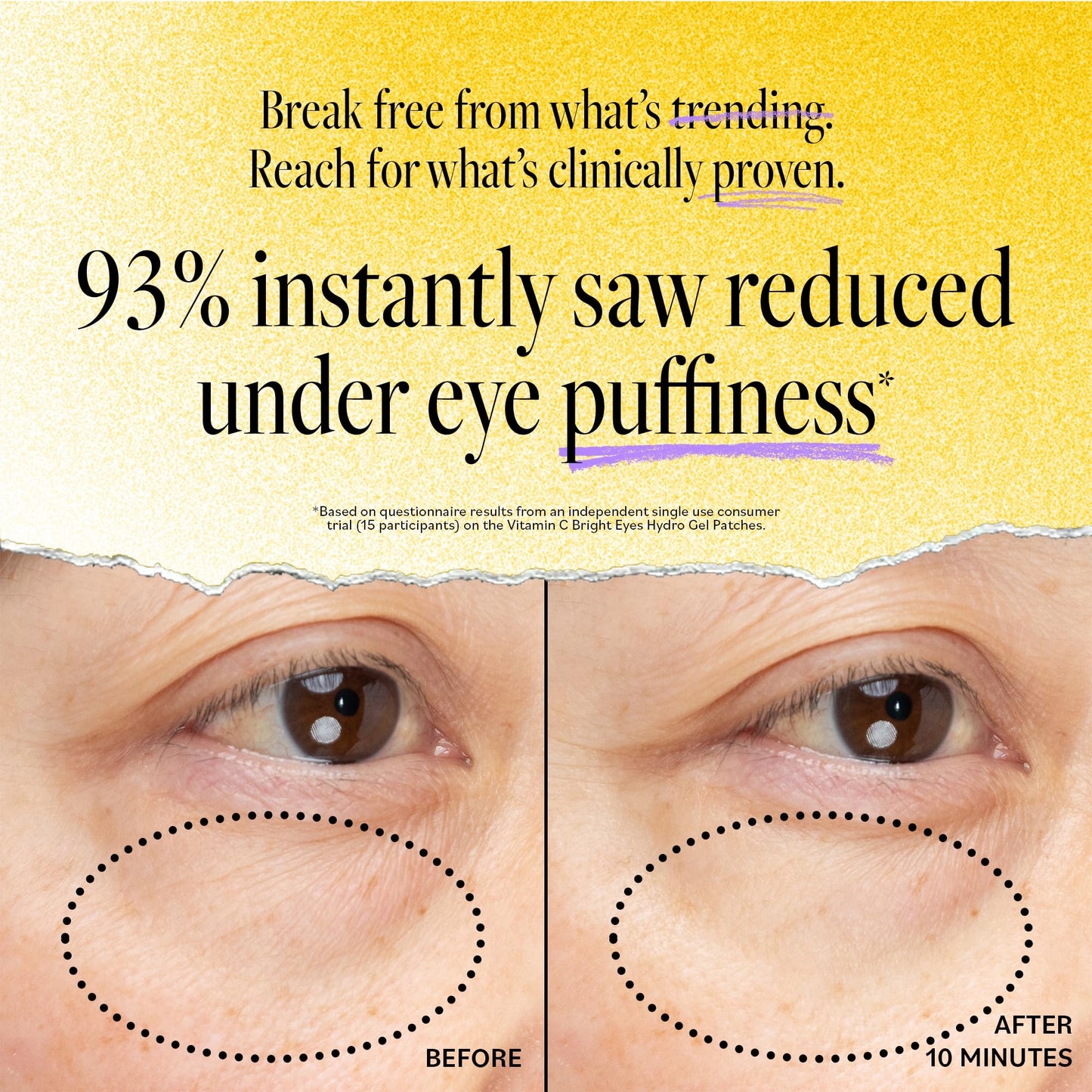 Derma E Vitamin C Bright Eyes Hydro Gel Patches, 30 Pairs (60ct) – Caffeine, Allantoin & Vitamin B3 for Dark Circles, Puffiness & Wrinkles