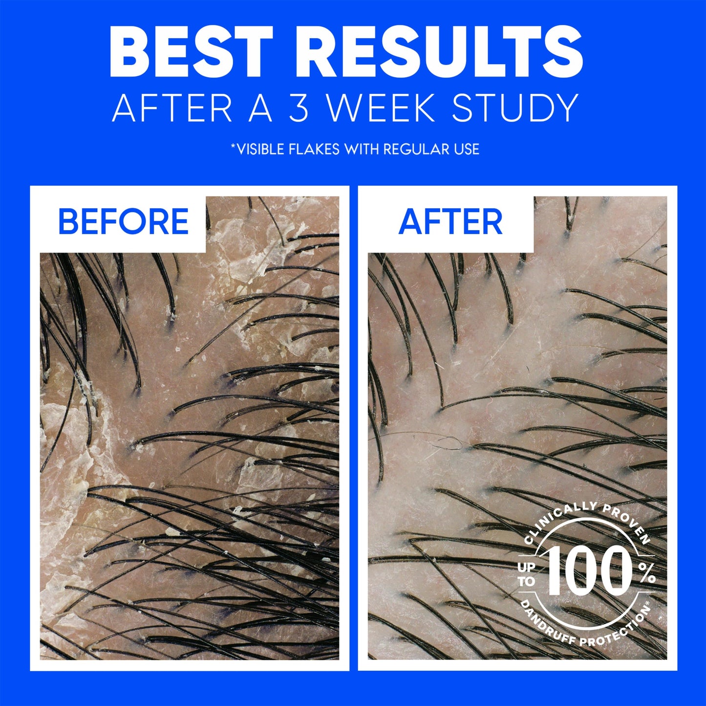 Head & Shoulders Dandruff Shampoo, Classic Clean, Twin Pack, Anti-Dandruff Daily Use, Paraben-Free, Color-Safe, 32.1 Fl Oz Each (Set of 2)